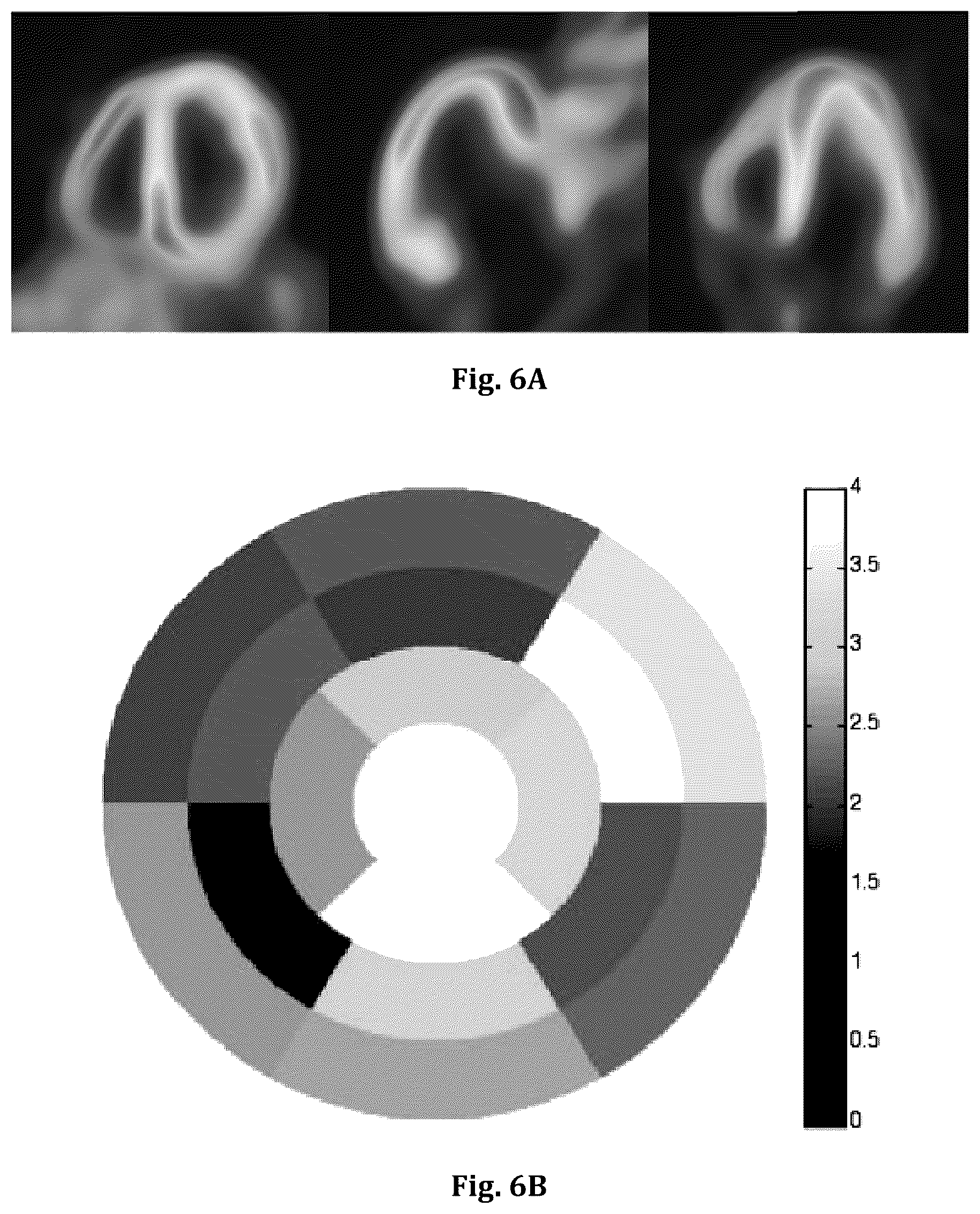 Patent US12551173 Figure 6 – System and method for single-scan rest-stress cardiac PET