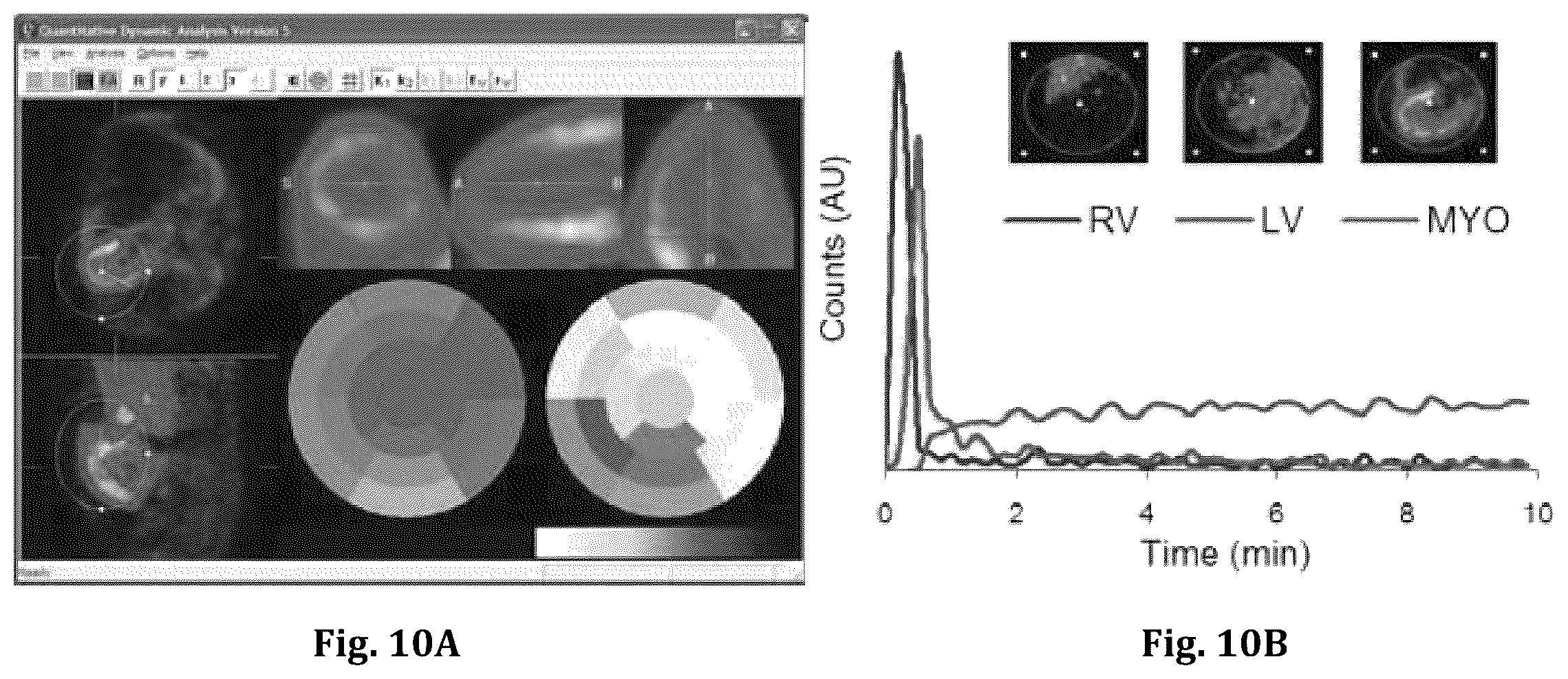 Patent US12551173 Figure 10 – System and method for single-scan rest-stress cardiac PET