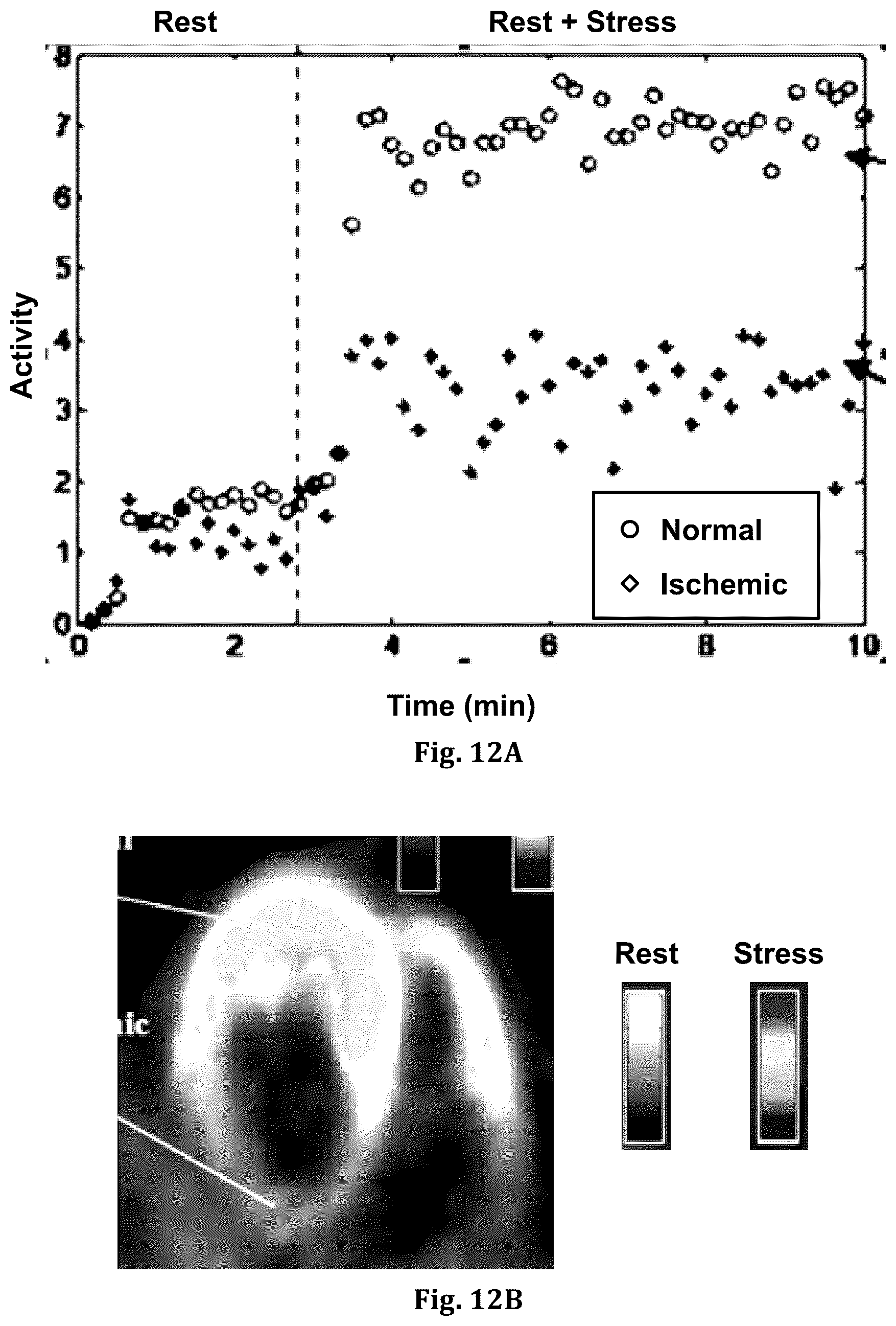 Patent US12551173 Figure 12 – System and method for single-scan rest-stress cardiac PET