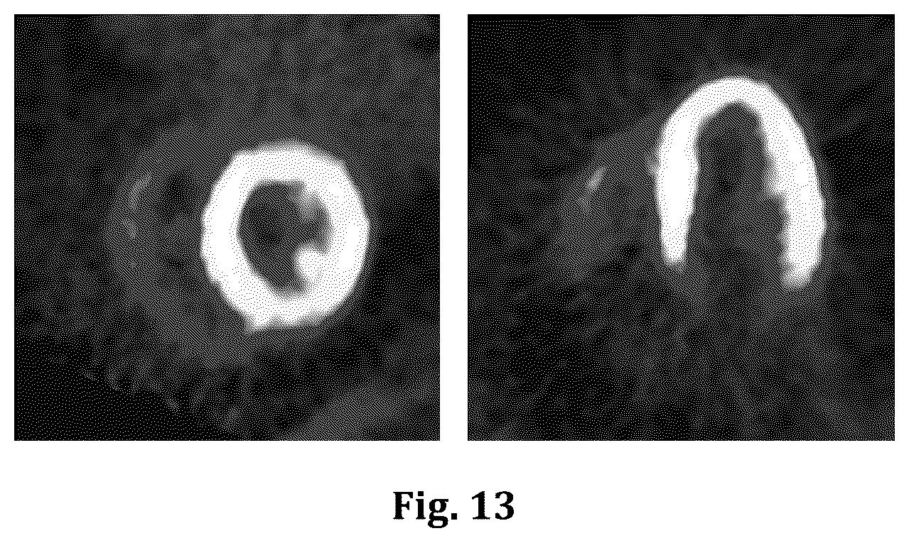 Patent US12551173 Figure 13 – System and method for single-scan rest-stress cardiac PET