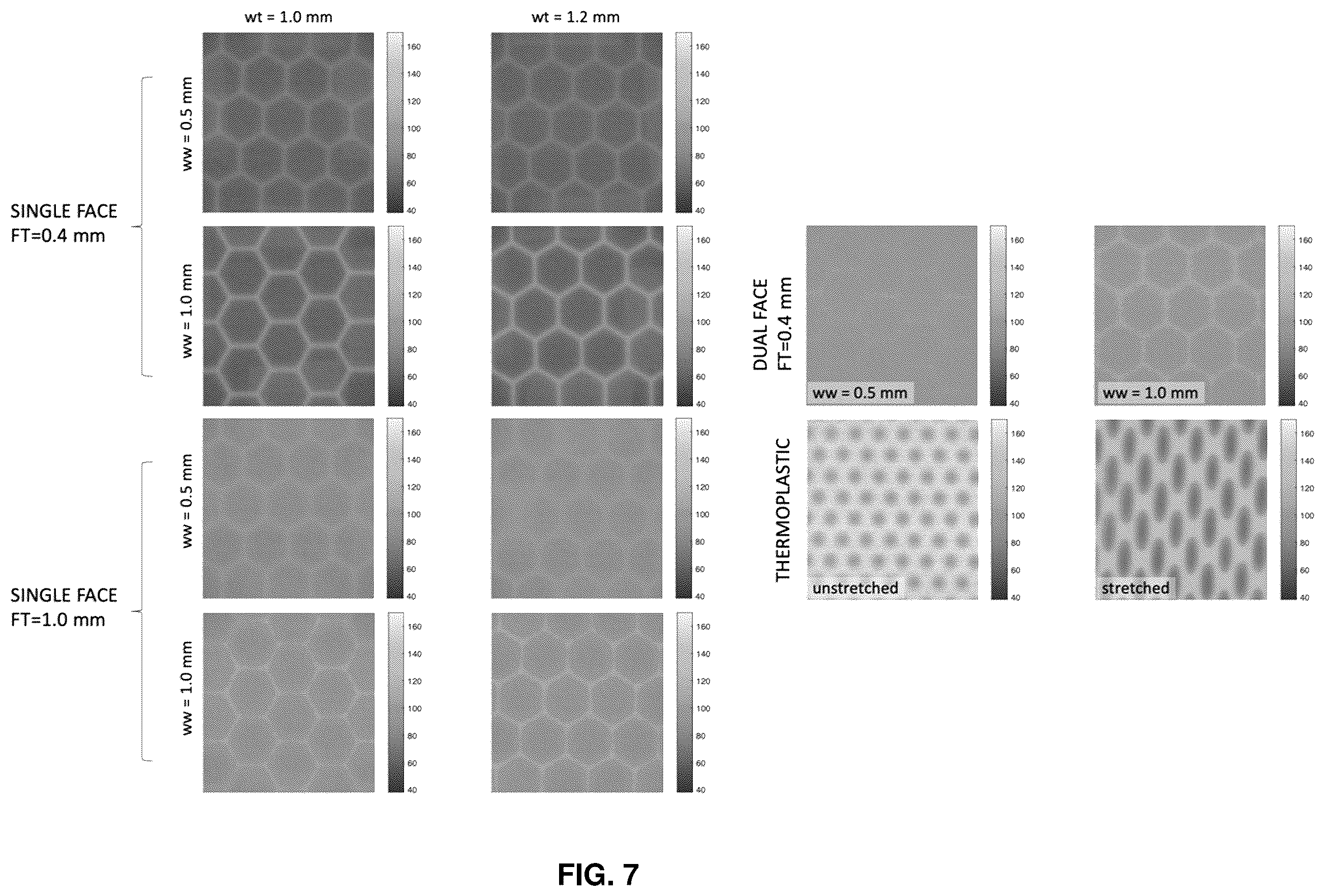 Patent US12551174 Figure 7 – Immobilization devices for radiation therapy