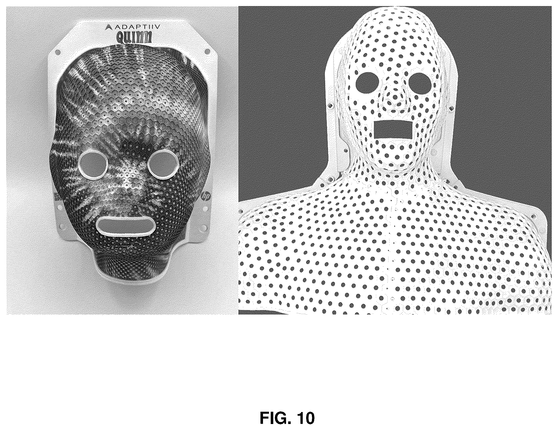 Patent US12551174 Figure 9 – Immobilization devices for radiation therapy
