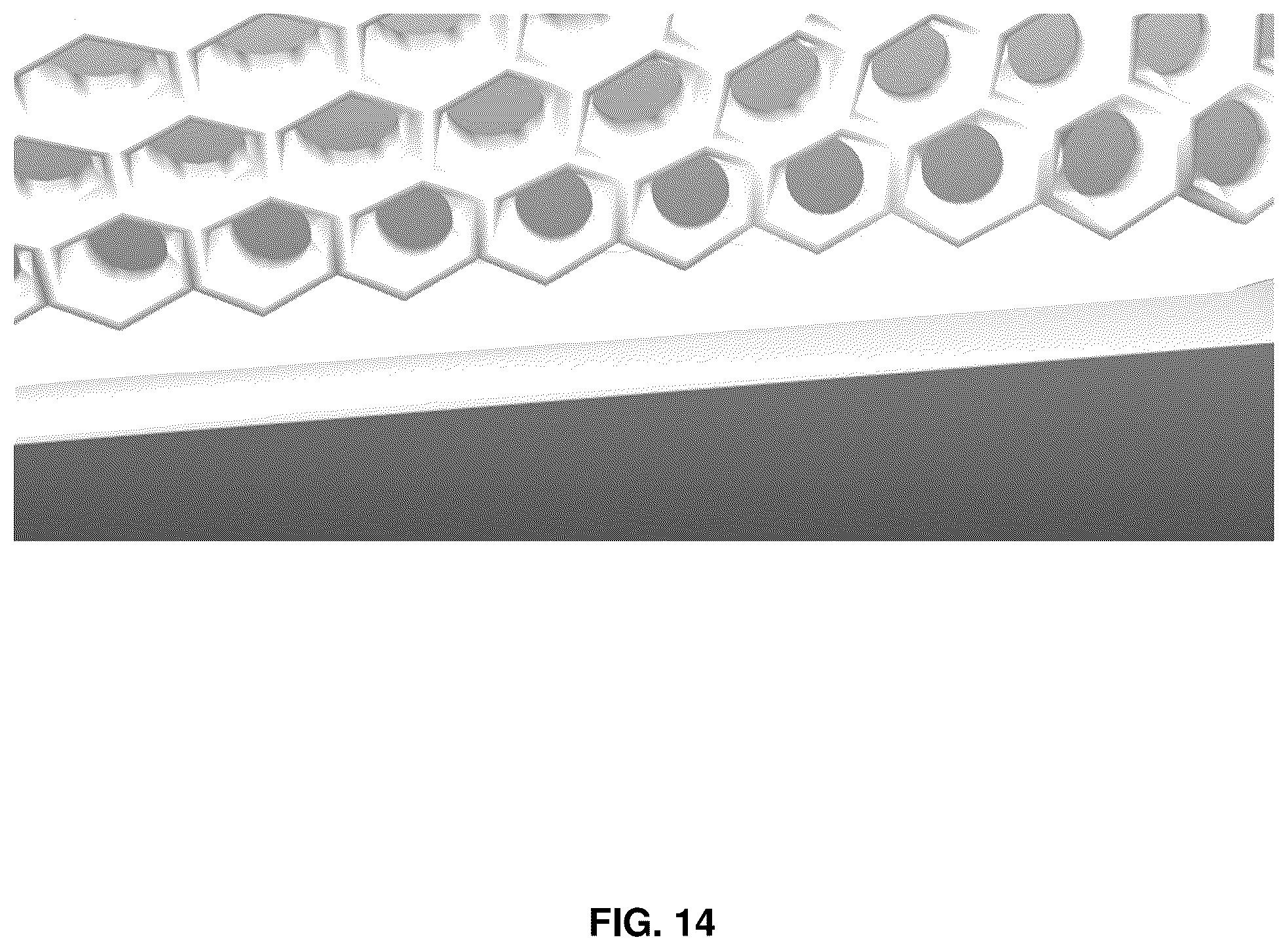 Patent US12551174 Figure 13 – Immobilization devices for radiation therapy