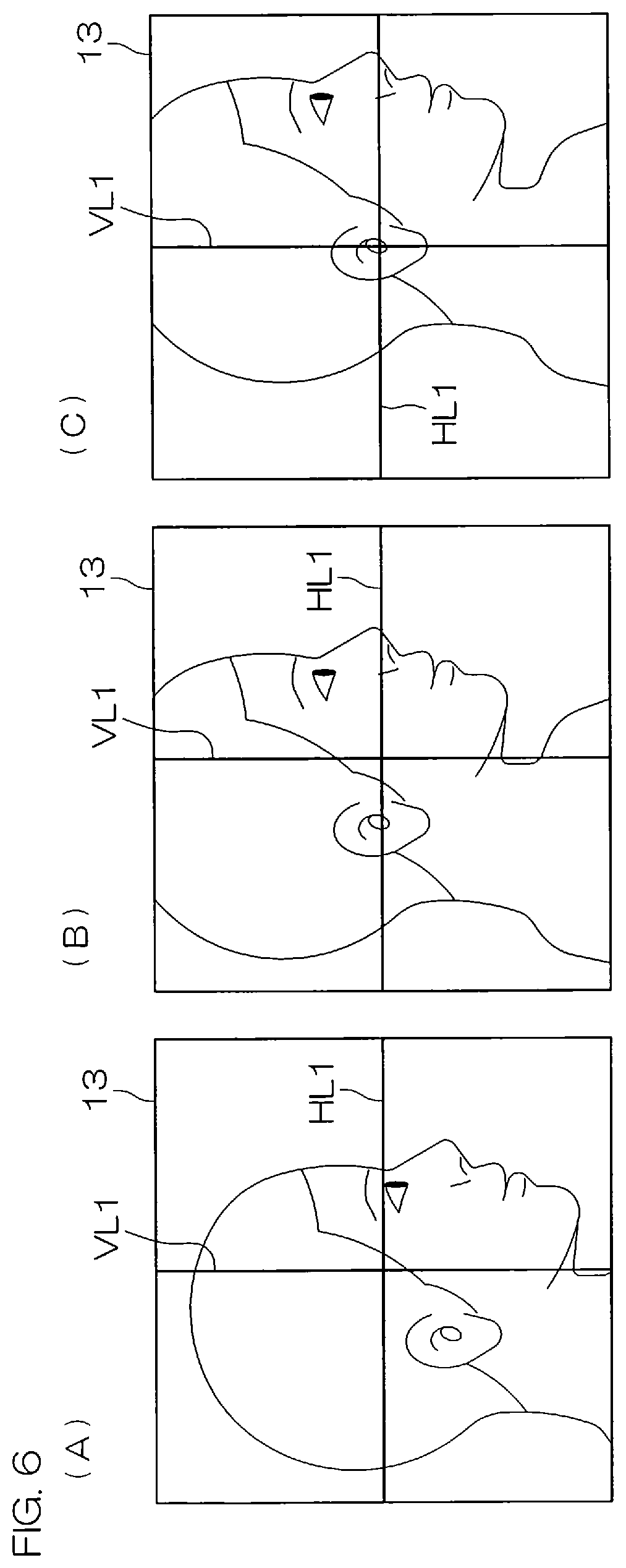 Patent US12551175 Figure 4 – Head positioning standardization method