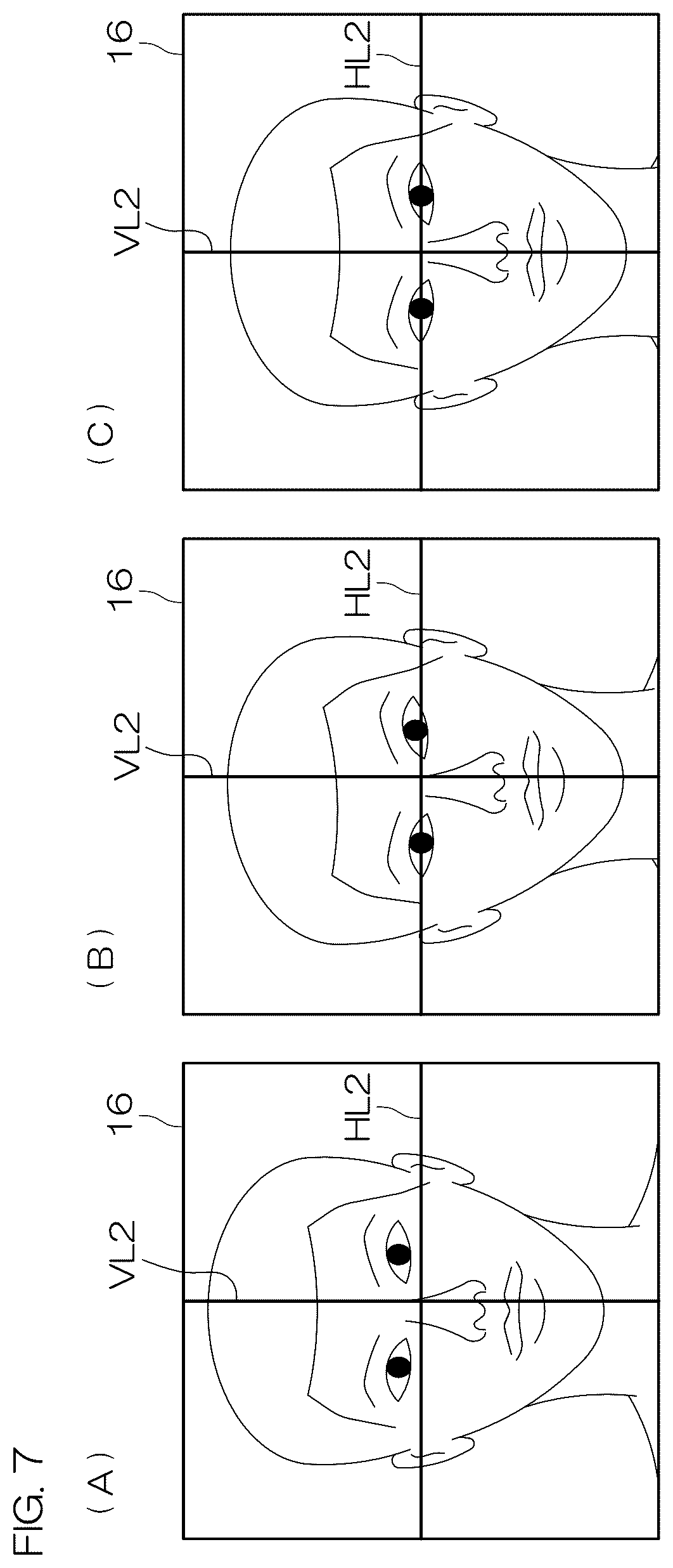 Patent US12551175 Figure 5 – Head positioning standardization method