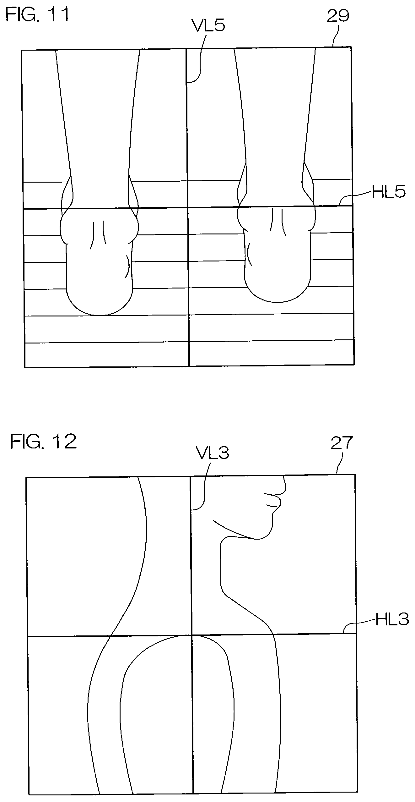 Patent US12551175 Figure 8 – Head positioning standardization method