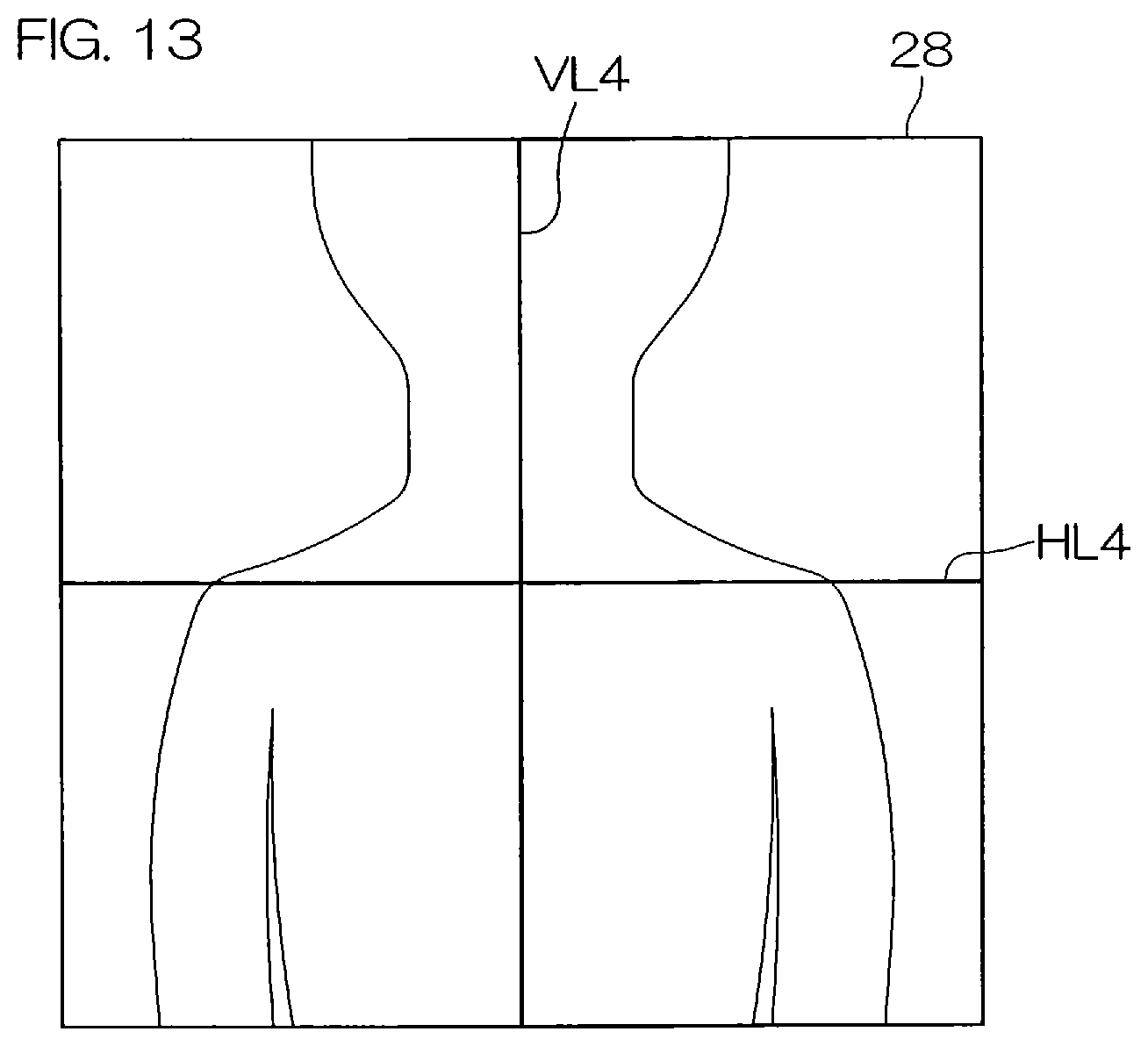 Patent US12551175 Figure 9 – Head positioning standardization method