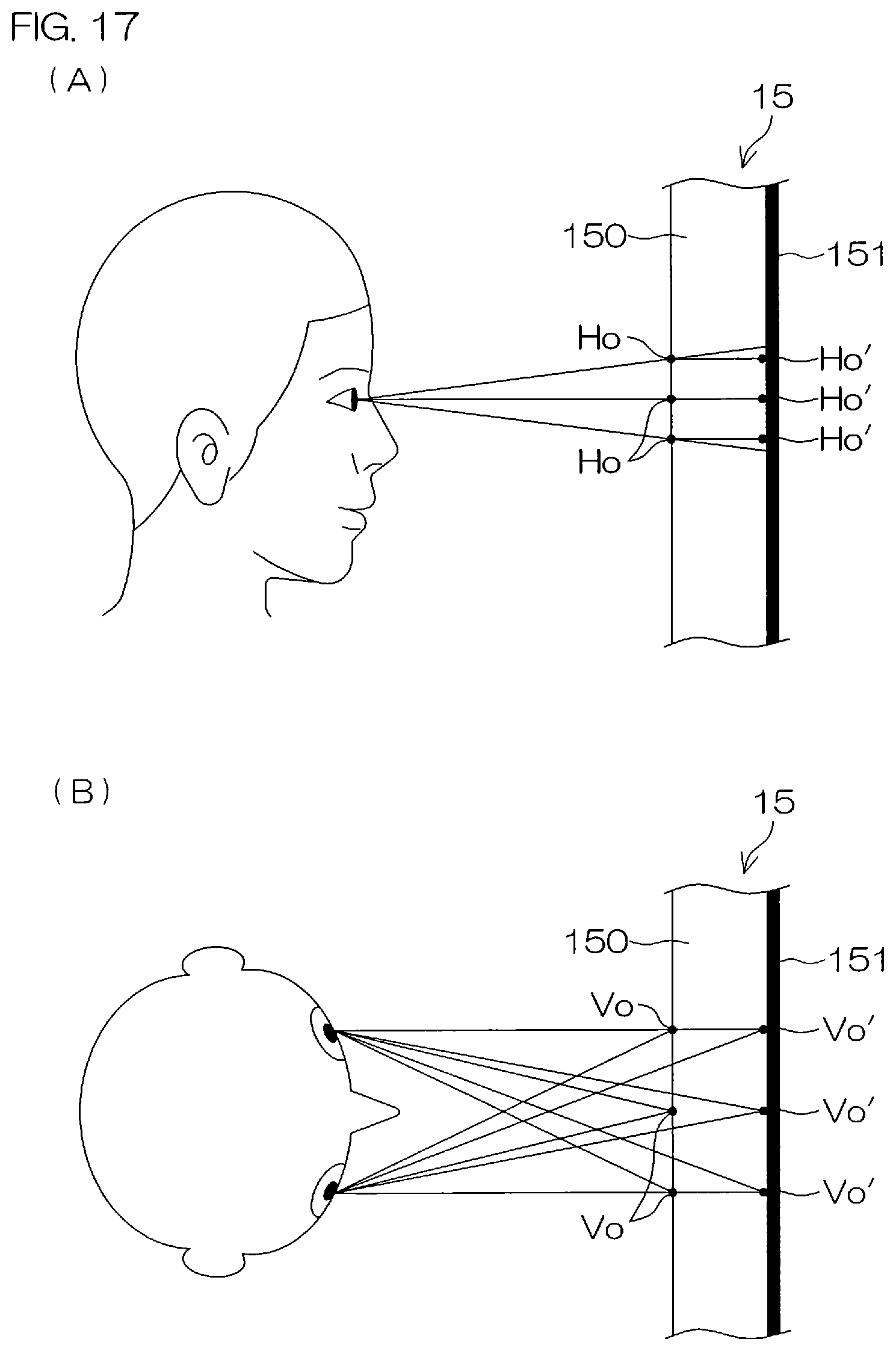Patent US12551175 Figure 13 – Head positioning standardization method