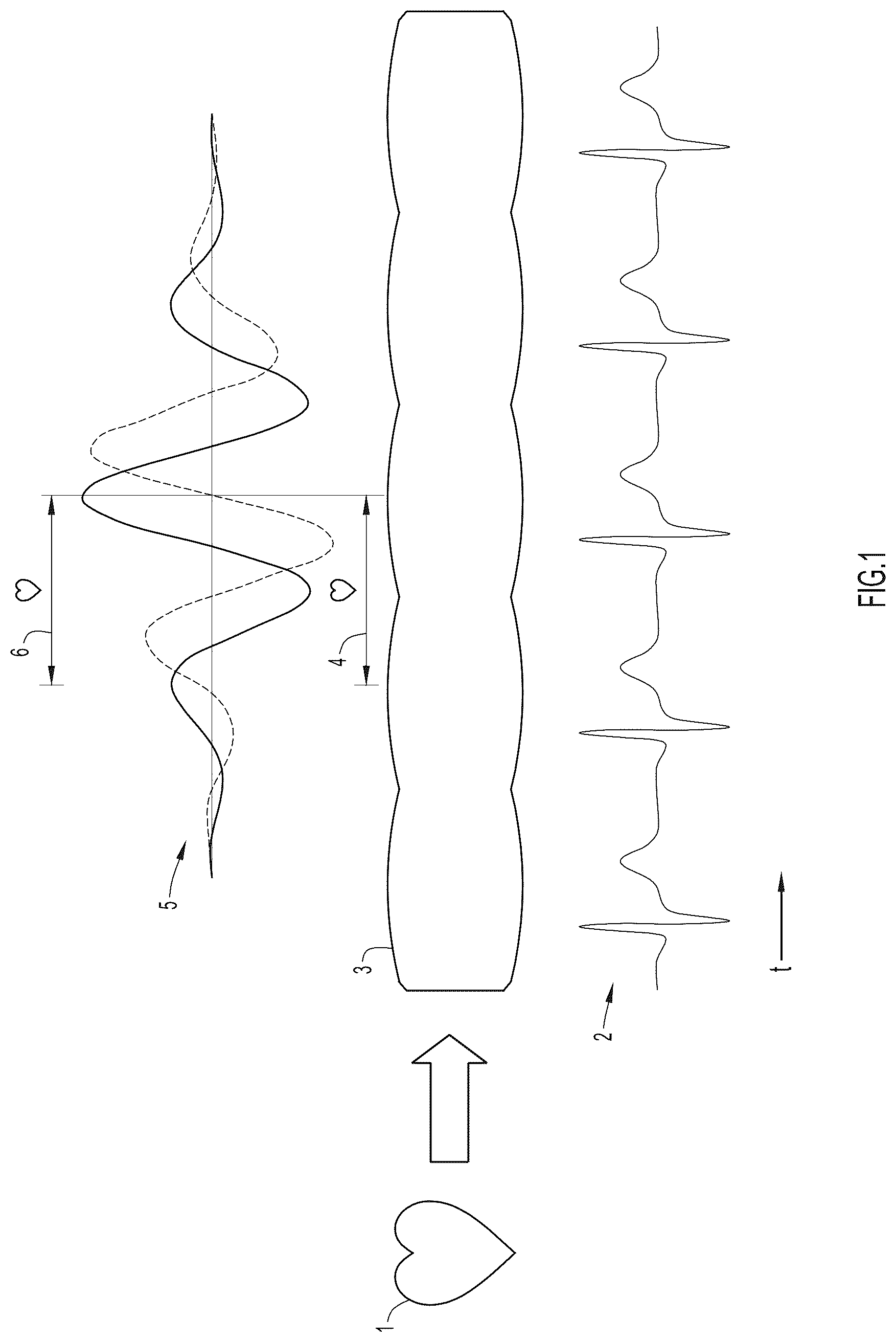 Patent US12551178 Figure 1 – Methods for angiography