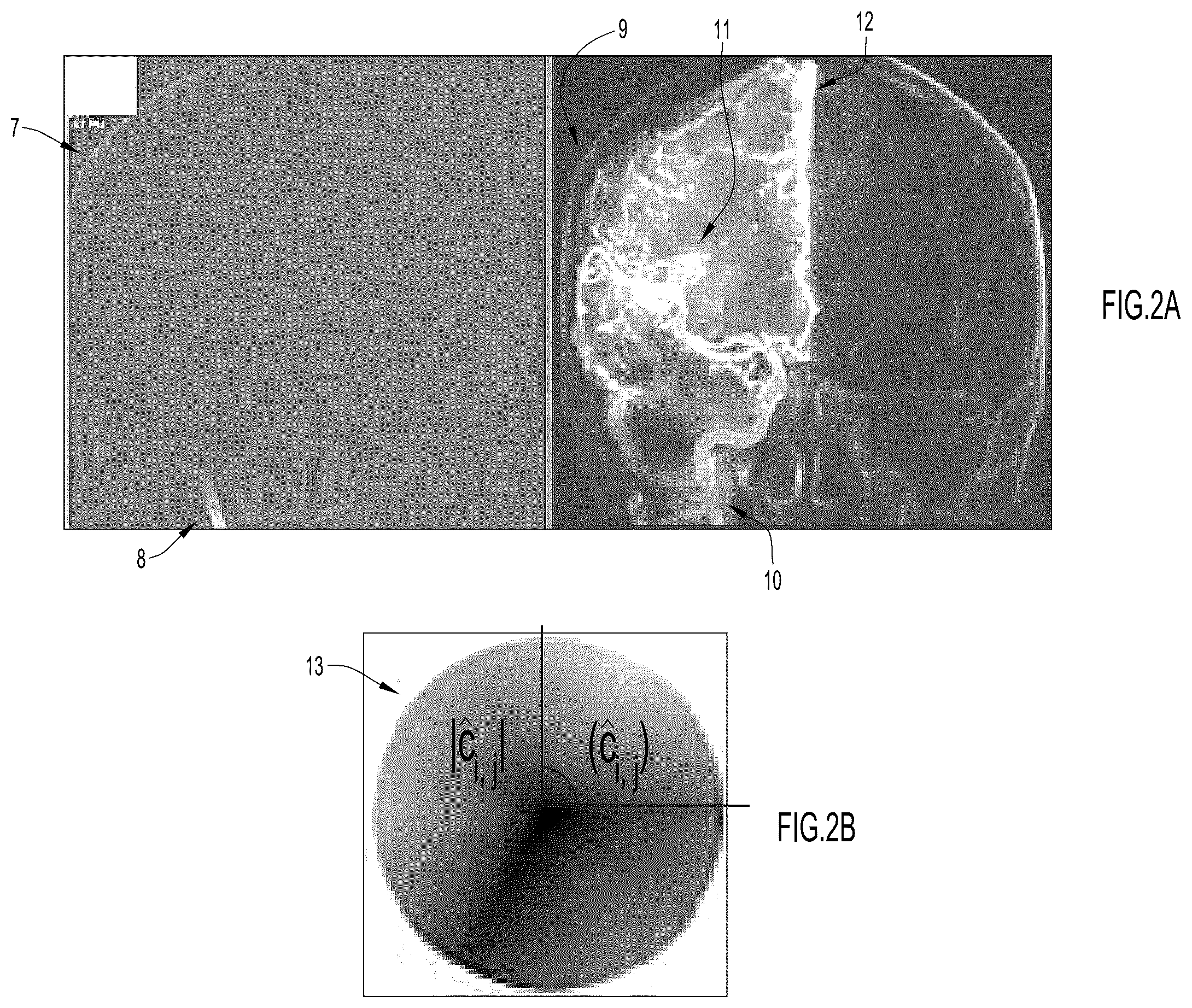 Patent US12551178 Figure 2 – Methods for angiography