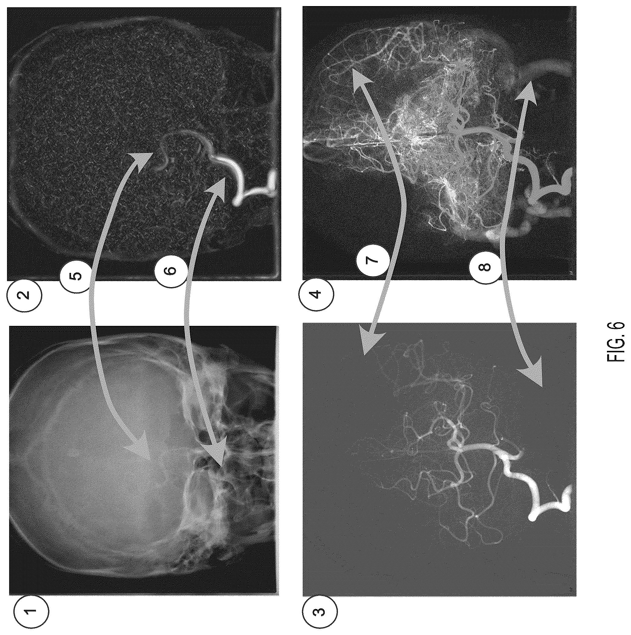 Patent US12551178 Figure 8 – Methods for angiography