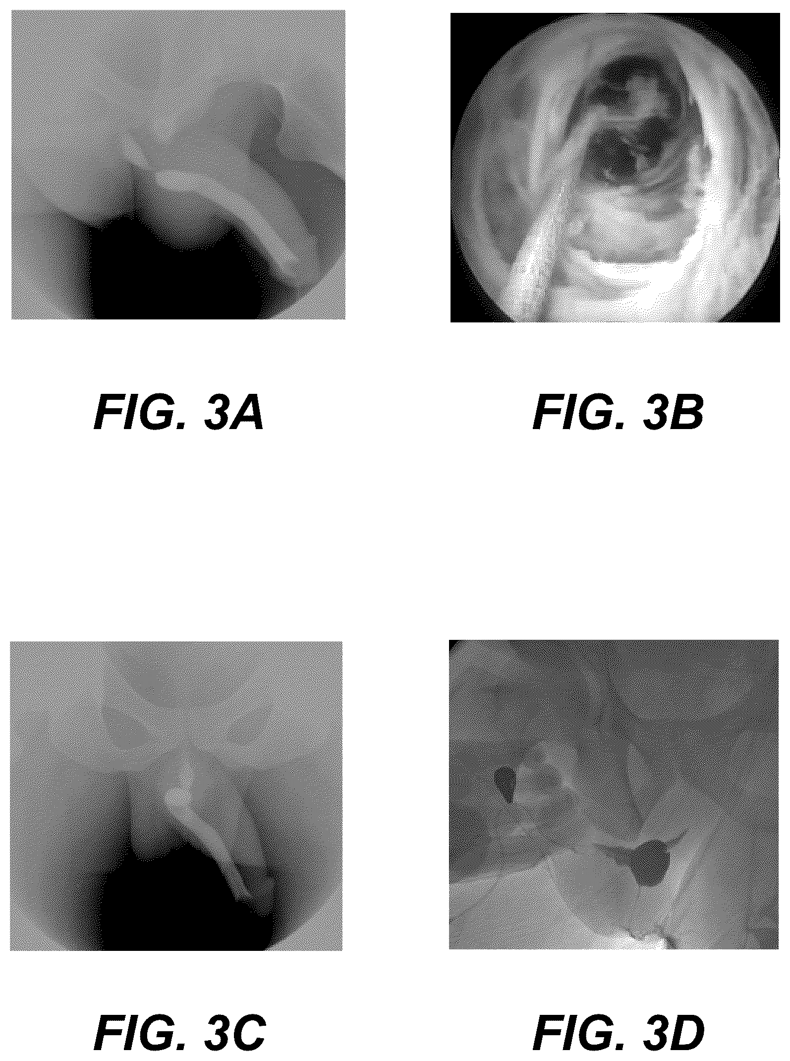Patent US12551179 Figure 4 – Fluoroscopic retrograde urethrogram instrument