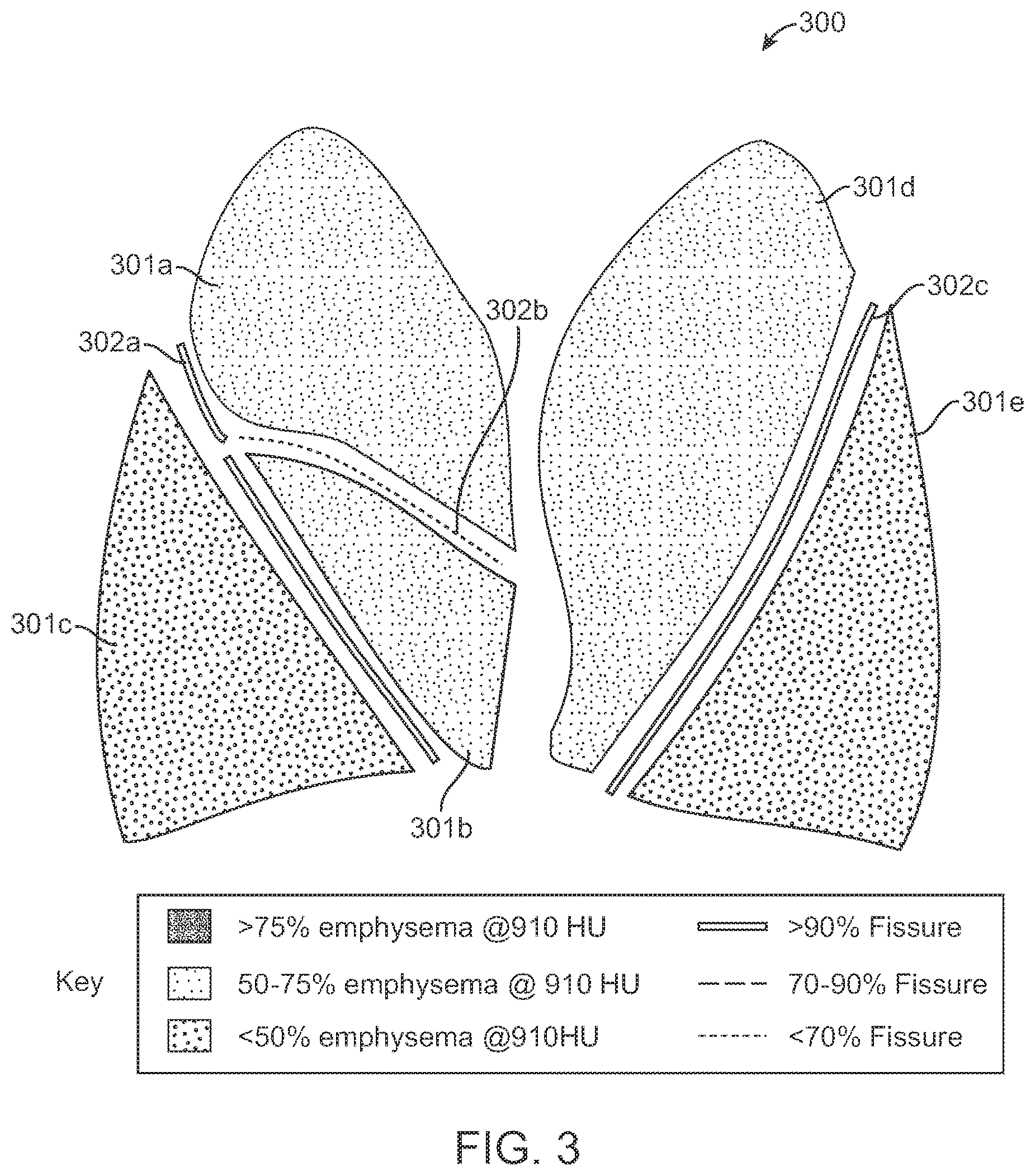 Patent US12551180 Figure 3 – Methods, systems, and devices for analyzing lung imaging data