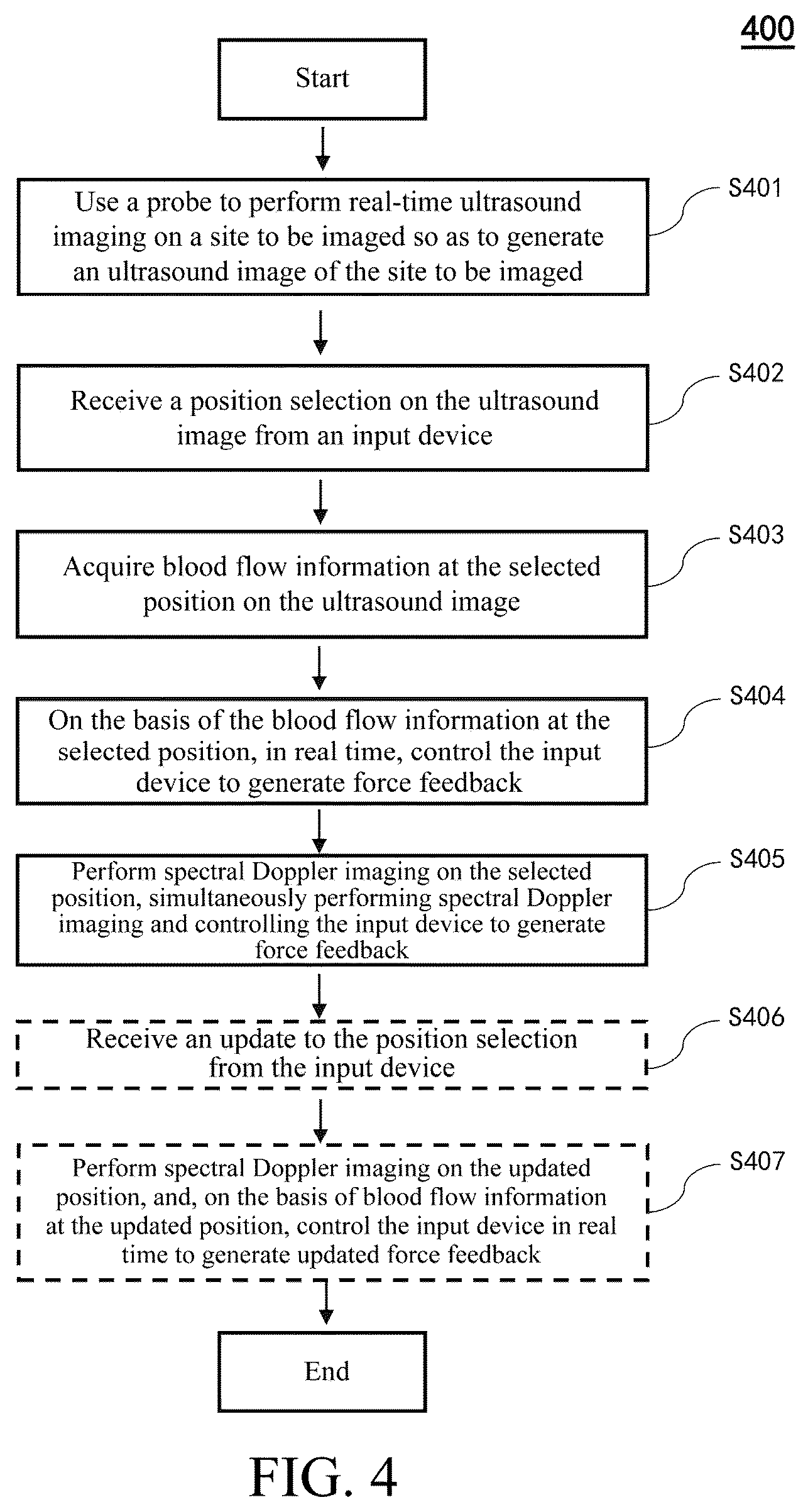Patent US12551184 Figure 4 – Ultrasound imaging method, ultrasound imaging system, and non-transitory computer-readable medium