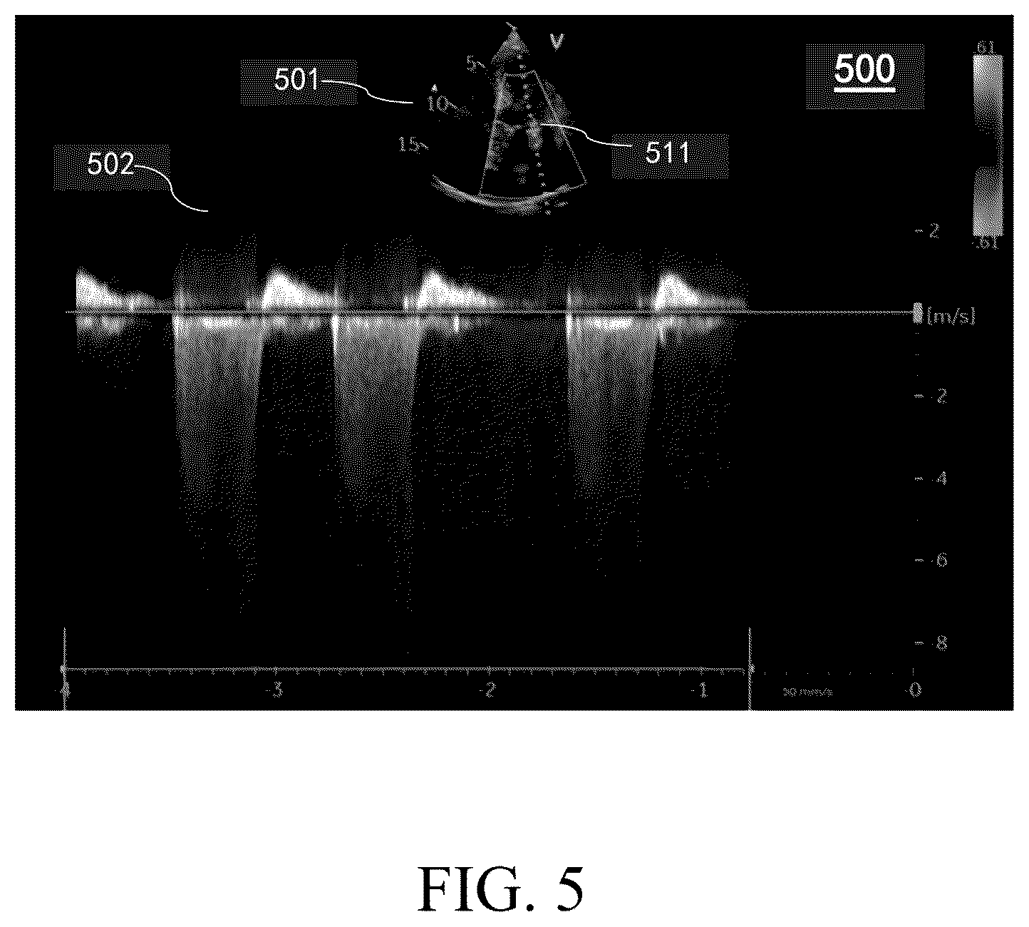 Patent US12551184 Figure 5 – Ultrasound imaging method, ultrasound imaging system, and non-transitory computer-readable medium