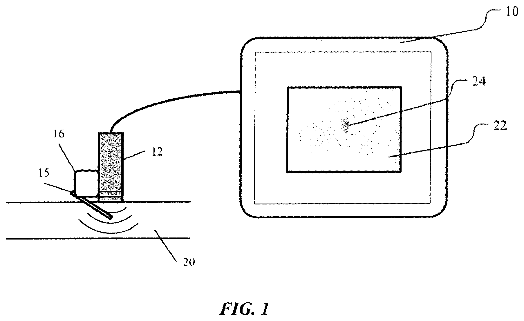 Patent US12551185 Figure 1 – On-screen markers for out-of-plane needle guidance