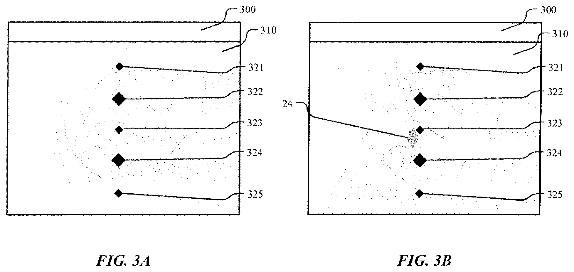 Patent US12551185 Figure 3 – On-screen markers for out-of-plane needle guidance