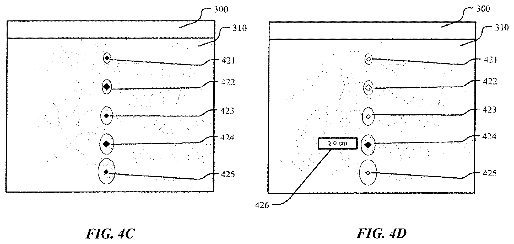 Patent US12551185 Figure 5 – On-screen markers for out-of-plane needle guidance