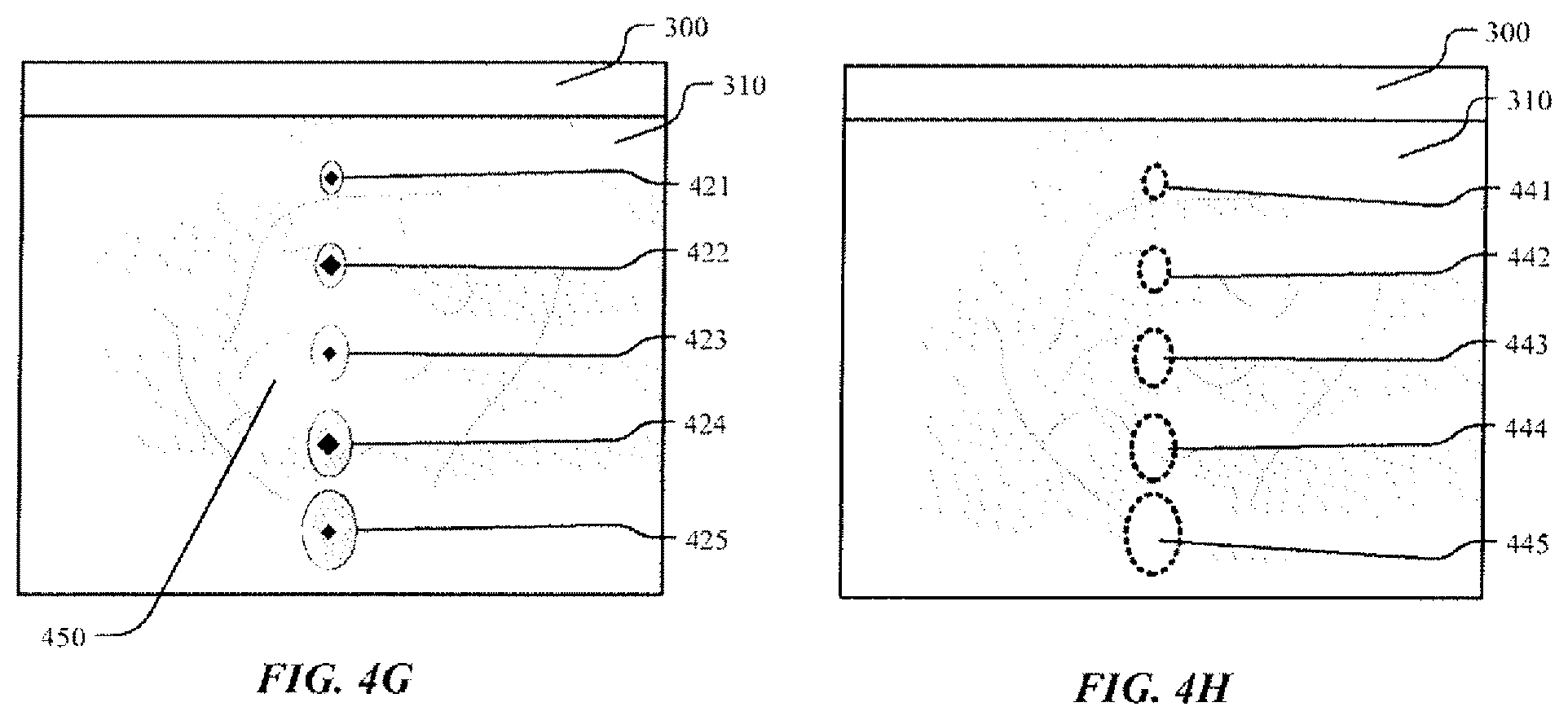 Patent US12551185 Figure 7 – On-screen markers for out-of-plane needle guidance