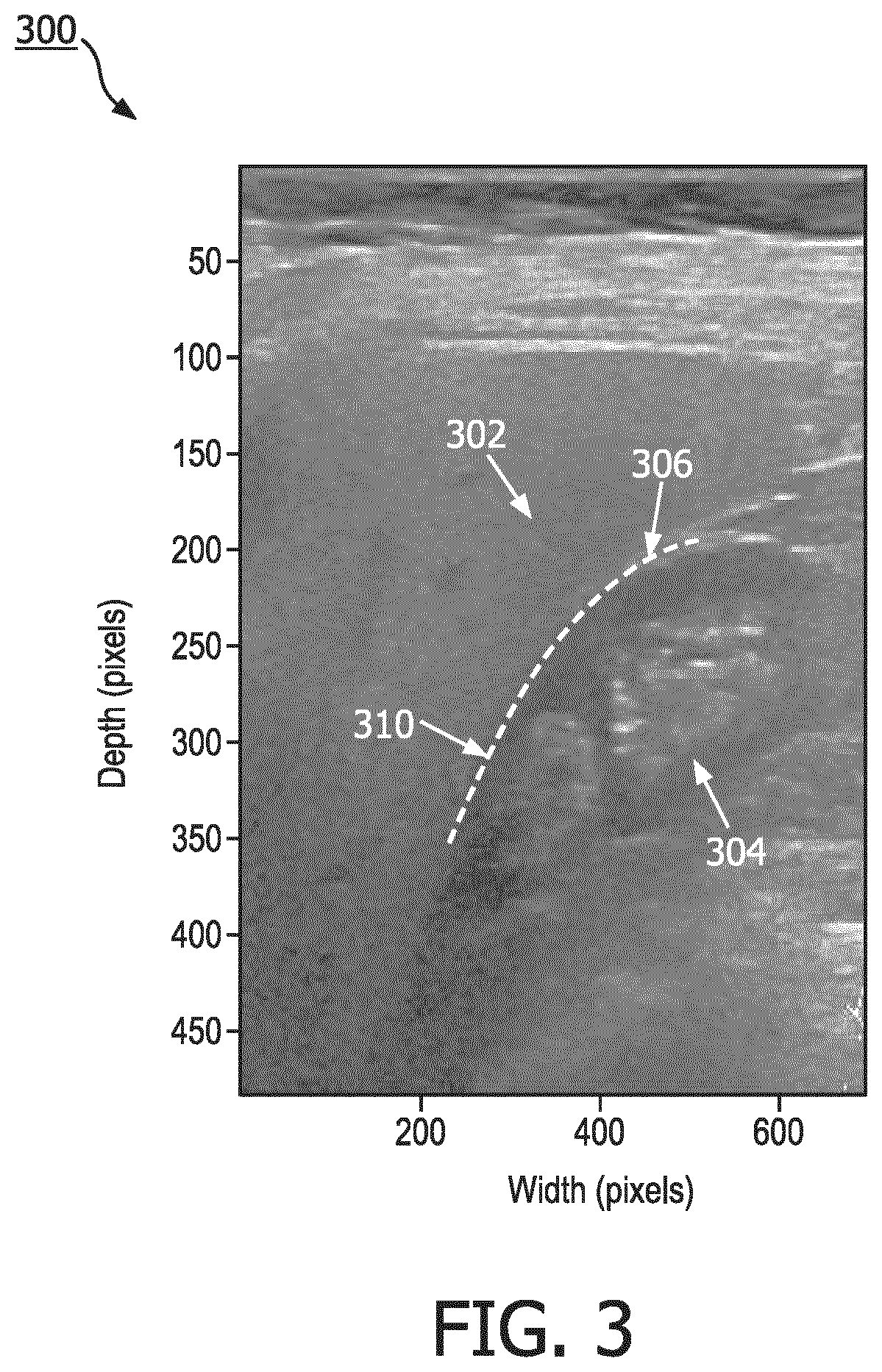 Patent US12551187 Figure 3 – Systems and methods of providing user guidance for acquiring hepato-renal index measurements