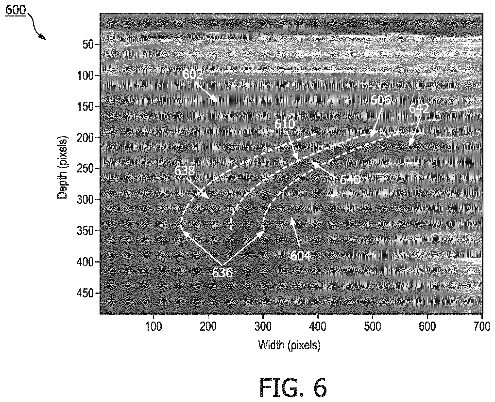 Patent US12551187 Figure 6 – Systems and methods of providing user guidance for acquiring hepato-renal index measurements