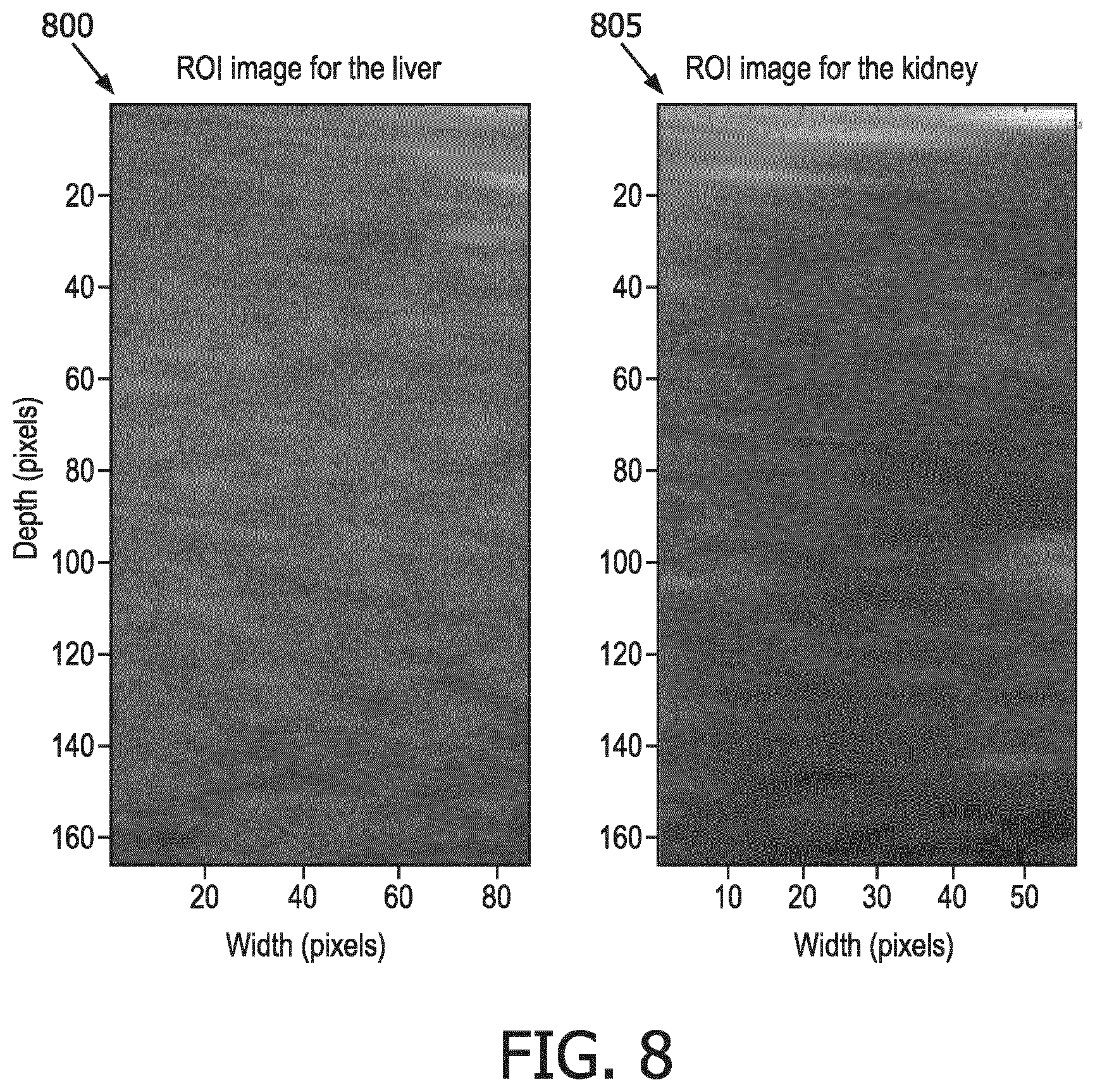 Patent US12551187 Figure 8 – Systems and methods of providing user guidance for acquiring hepato-renal index measurements