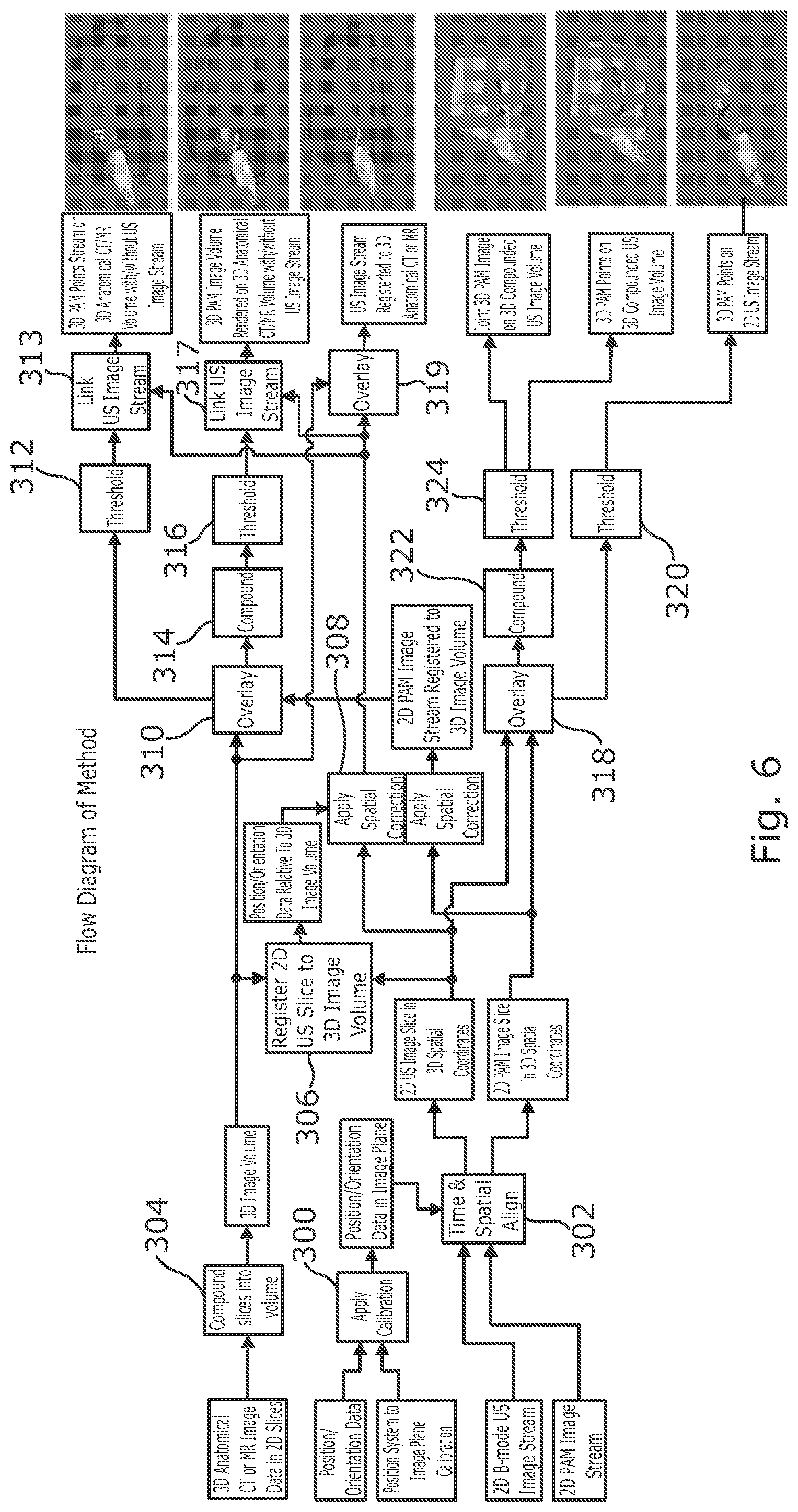 Patent US12551188 Figure 4 – Mapping of cavitation activity