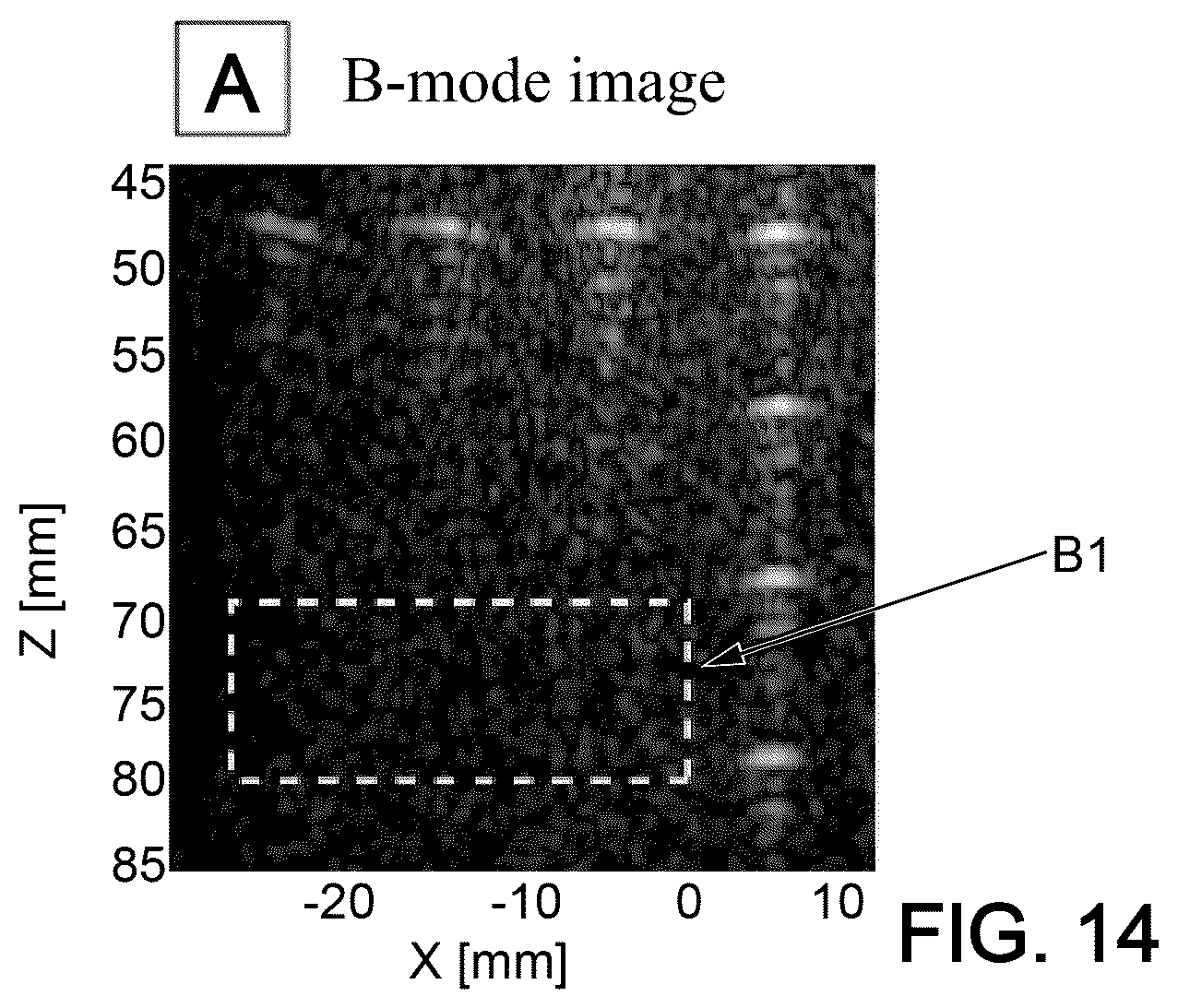 Patent US12551189 Figure 10 – Method and system for characterising a medium using ultrasound