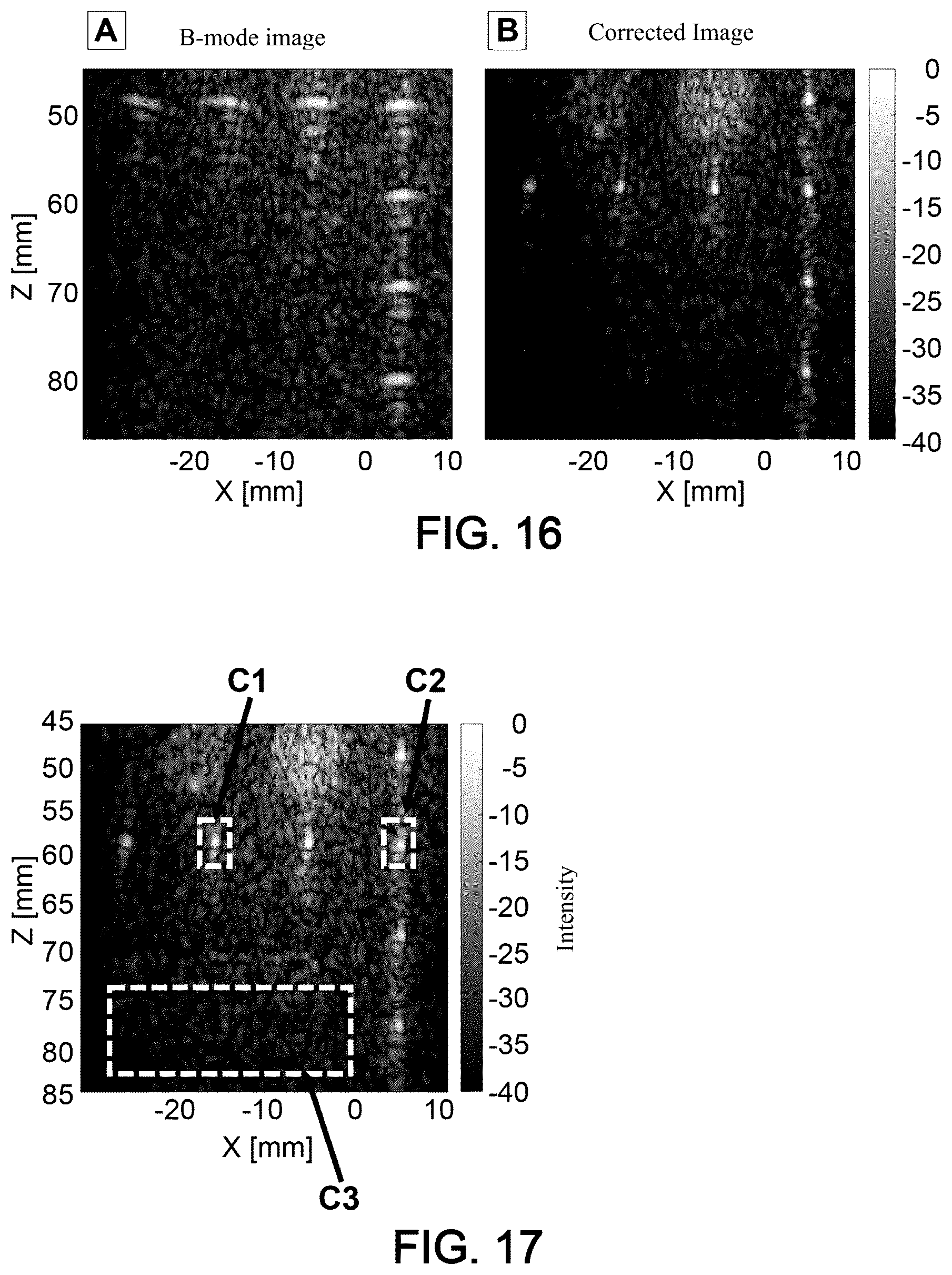 Patent US12551189 Figure 12 – Method and system for characterising a medium using ultrasound