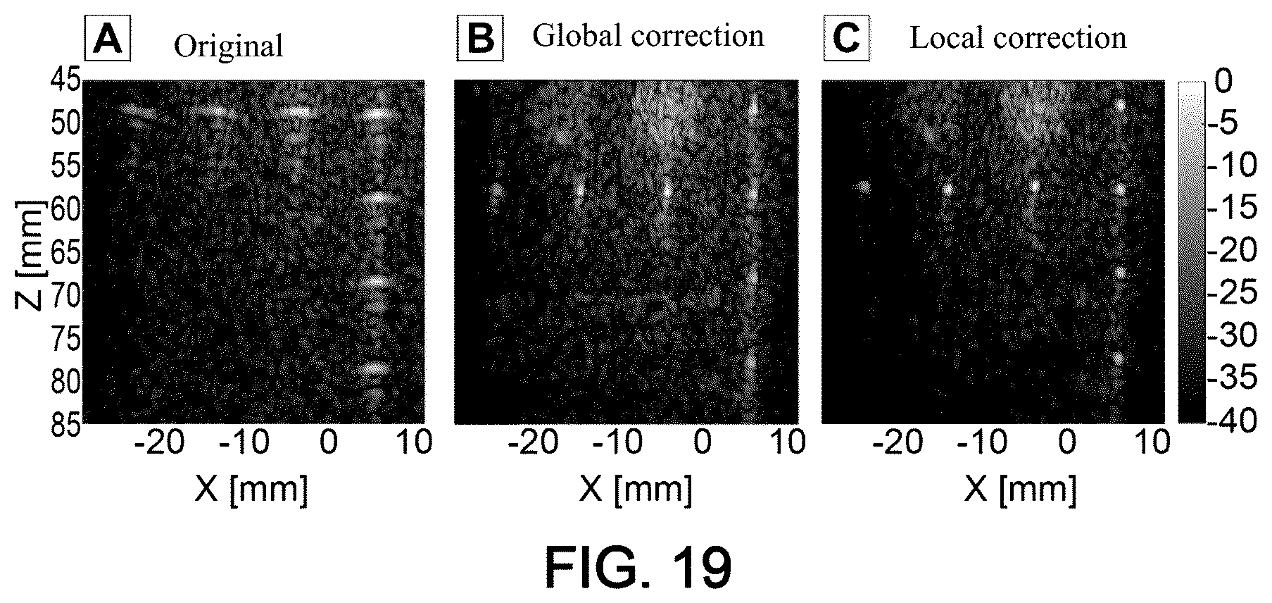 Patent US12551189 Figure 14 – Method and system for characterising a medium using ultrasound