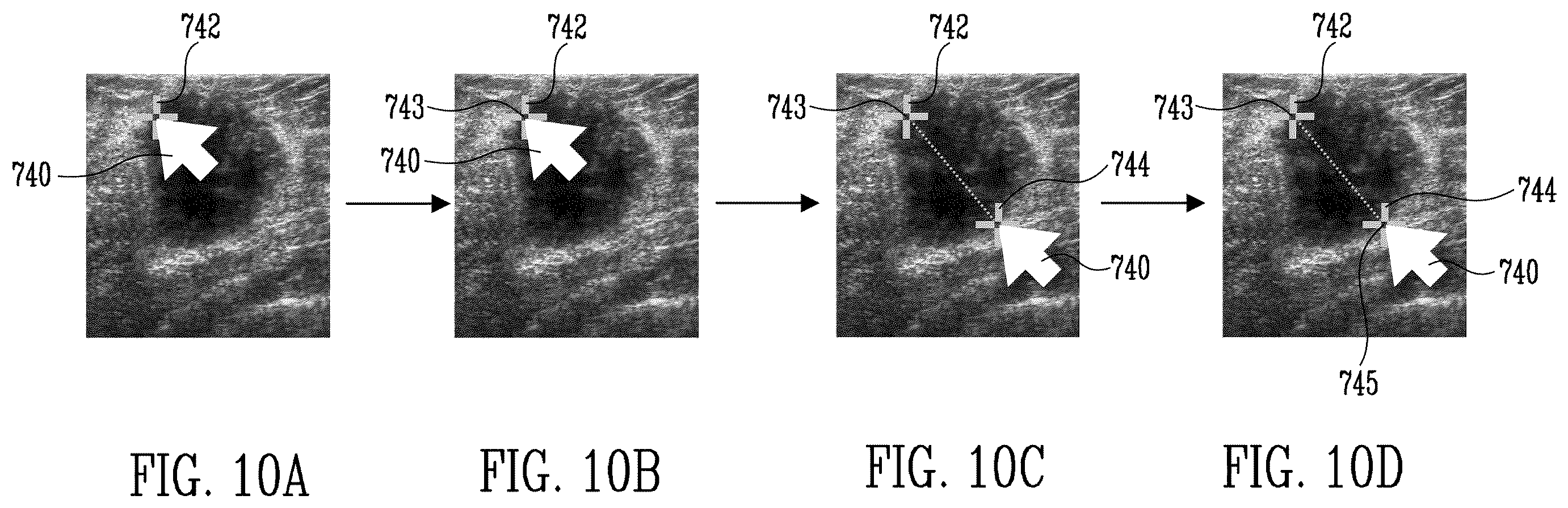 Patent US12551191 Figure 14 – Ultrasound remote diagnosis system and method thereof