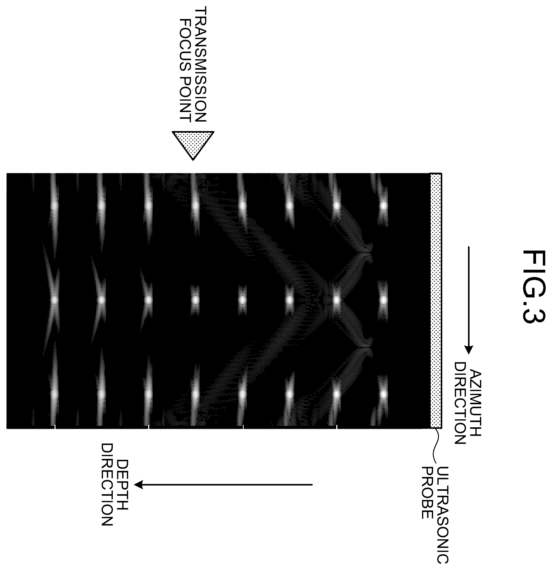 Patent US12551192 Figure 2 – Ultrasonic diagnostic apparatus and medical image processing apparatus