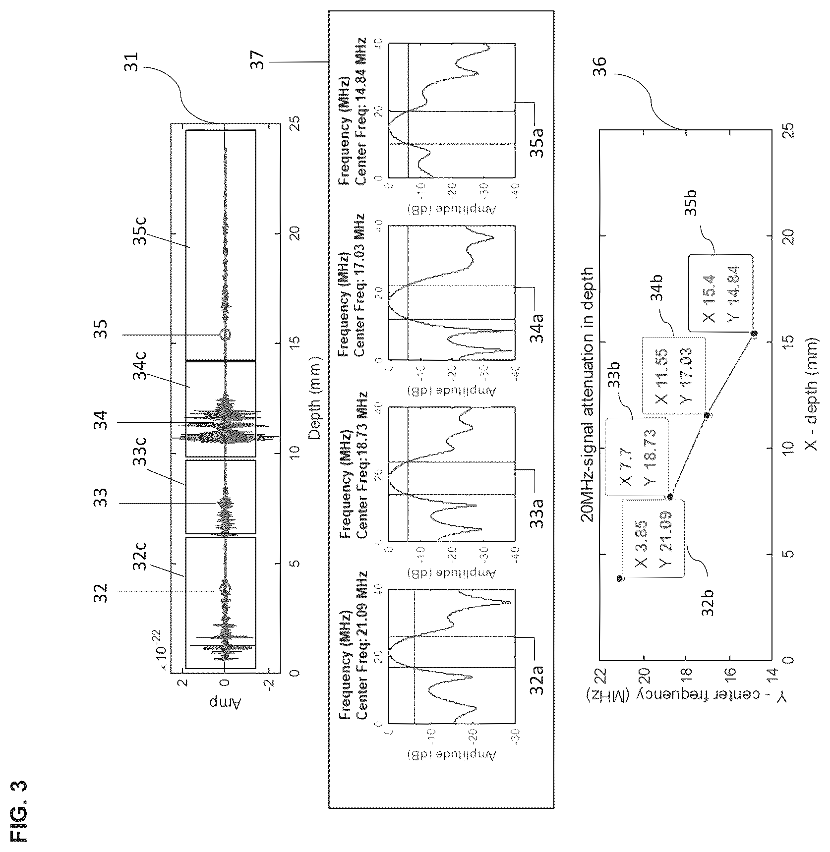 Patent US12551194 Figure 3 – Image processing method for multi-frequency ultrasound probe device