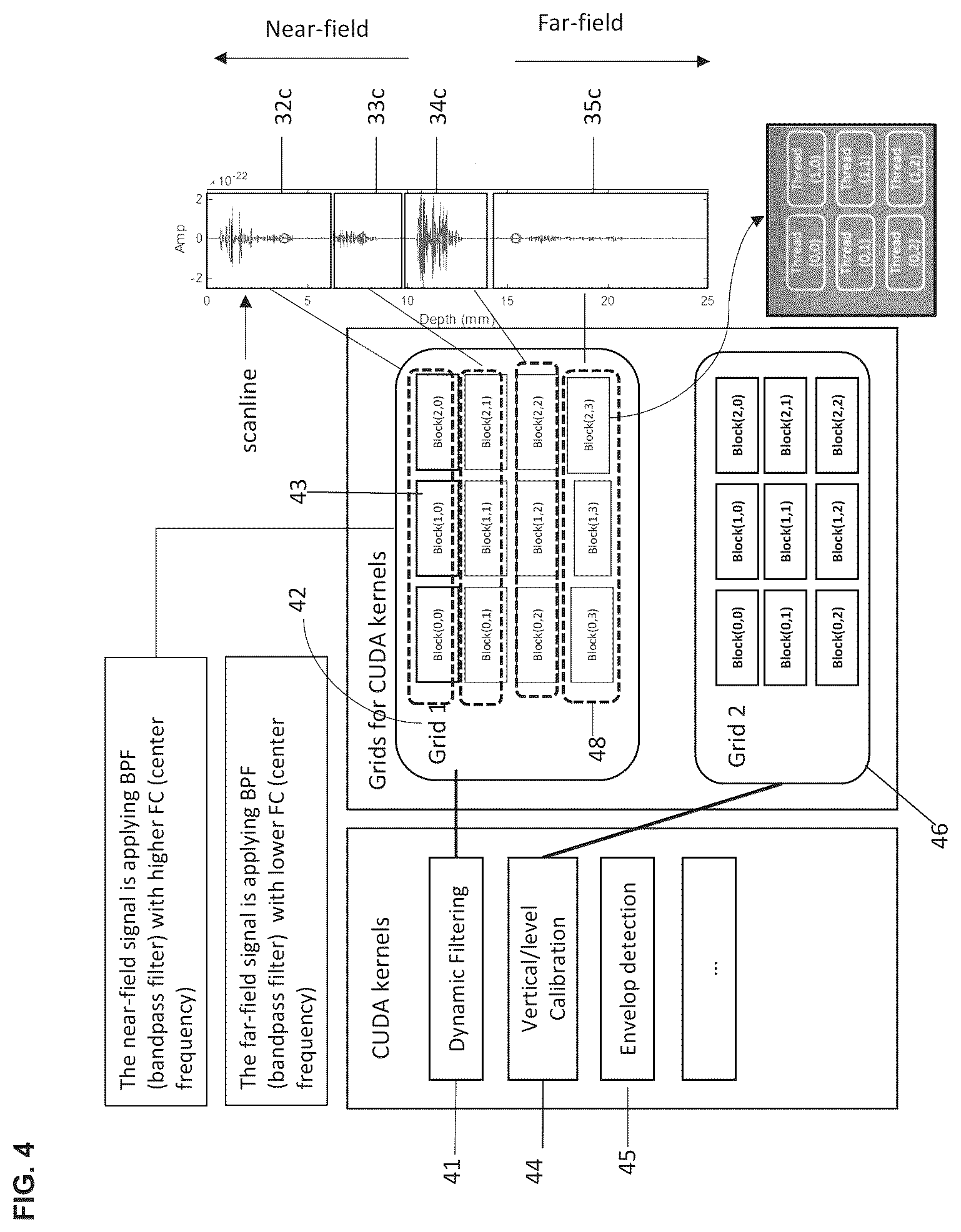 Patent US12551194 Figure 4 – Image processing method for multi-frequency ultrasound probe device
