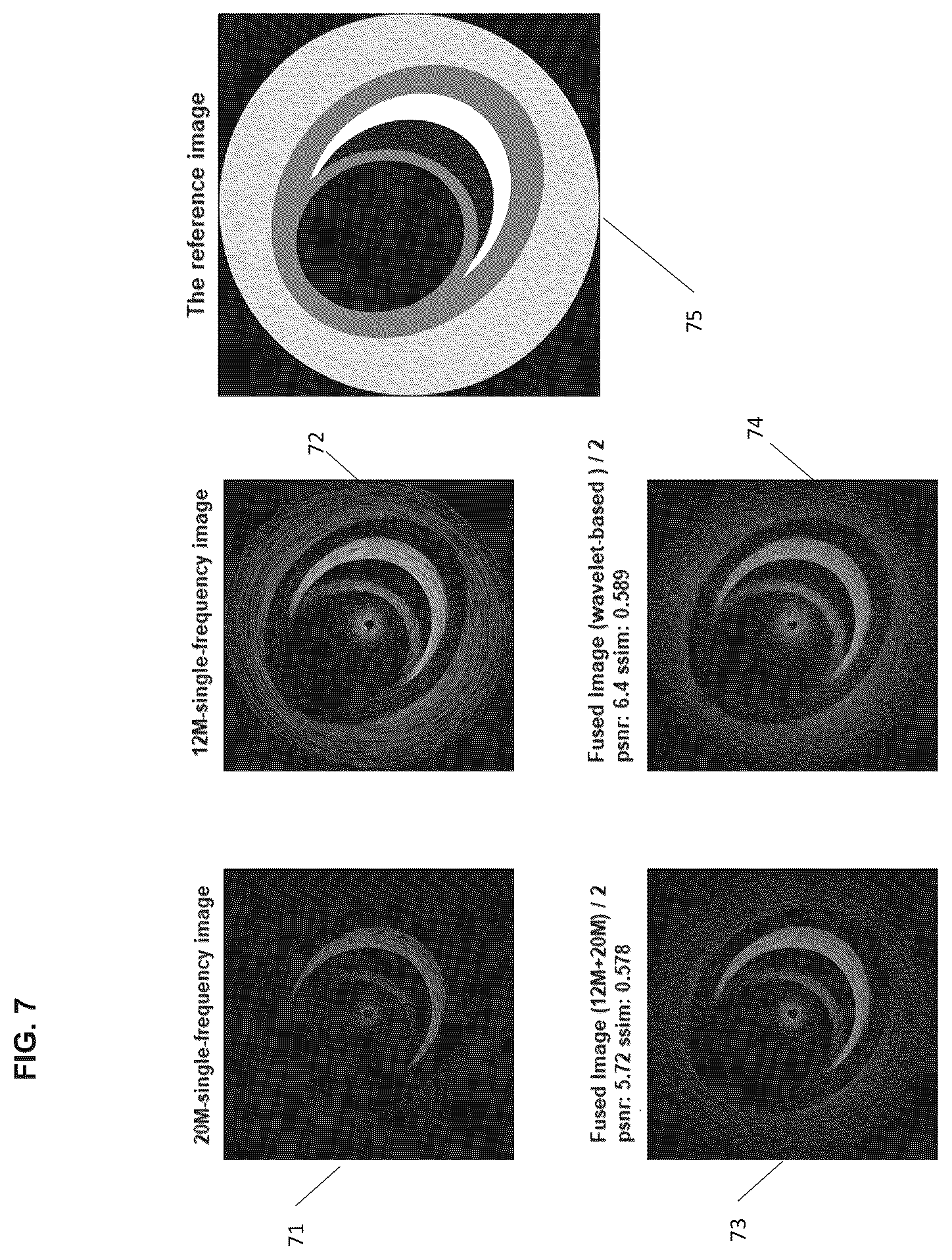 Patent US12551194 Figure 7 – Image processing method for multi-frequency ultrasound probe device
