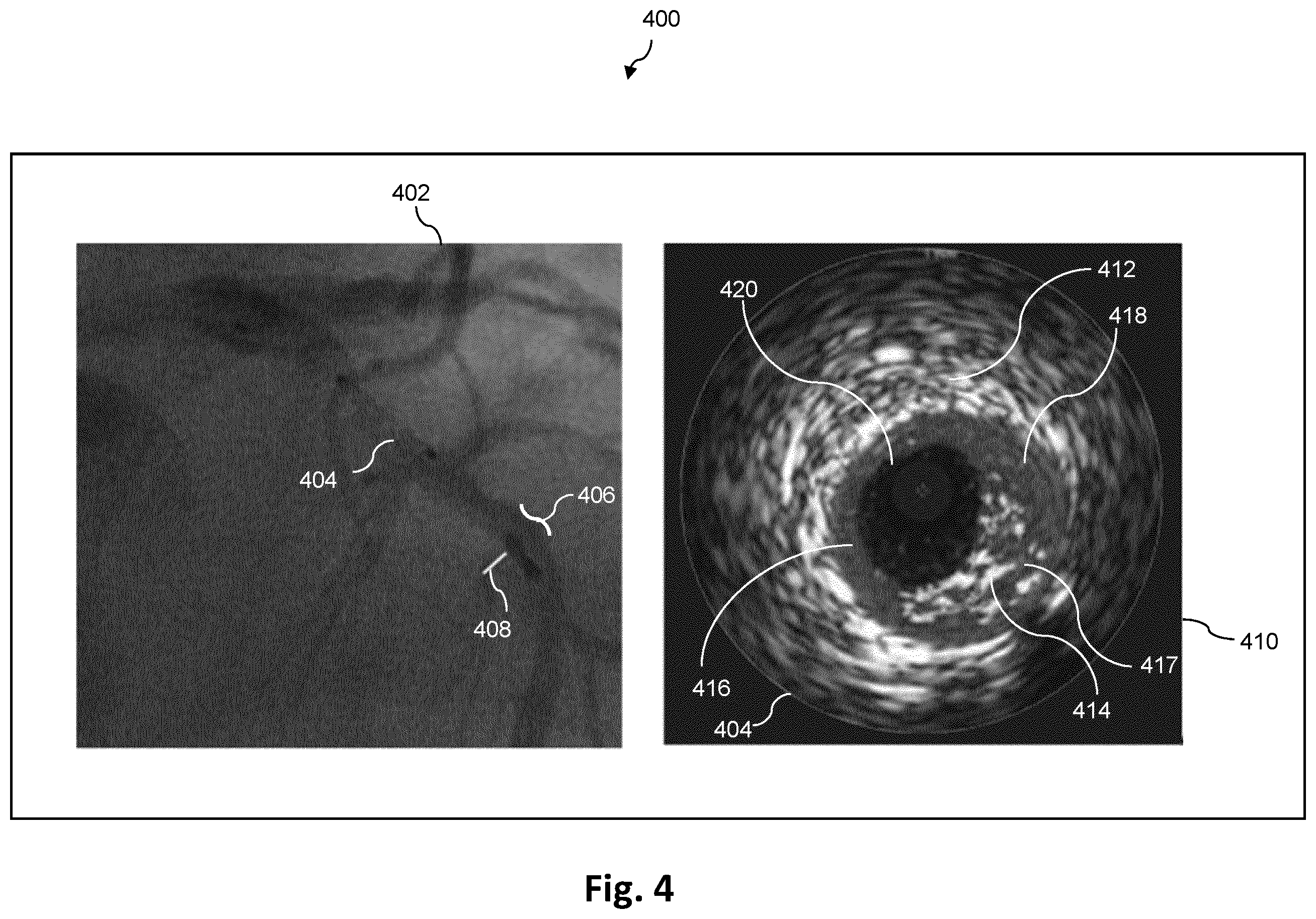 Patent US12551195 Figure 4 – Co-registration of intravascular and extravascular imaging for extravascular image with intravascular tissue morphology