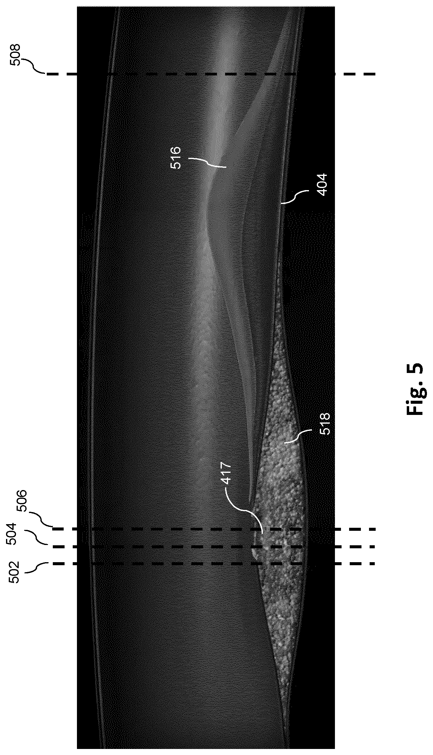 Patent US12551195 Figure 5 – Co-registration of intravascular and extravascular imaging for extravascular image with intravascular tissue morphology