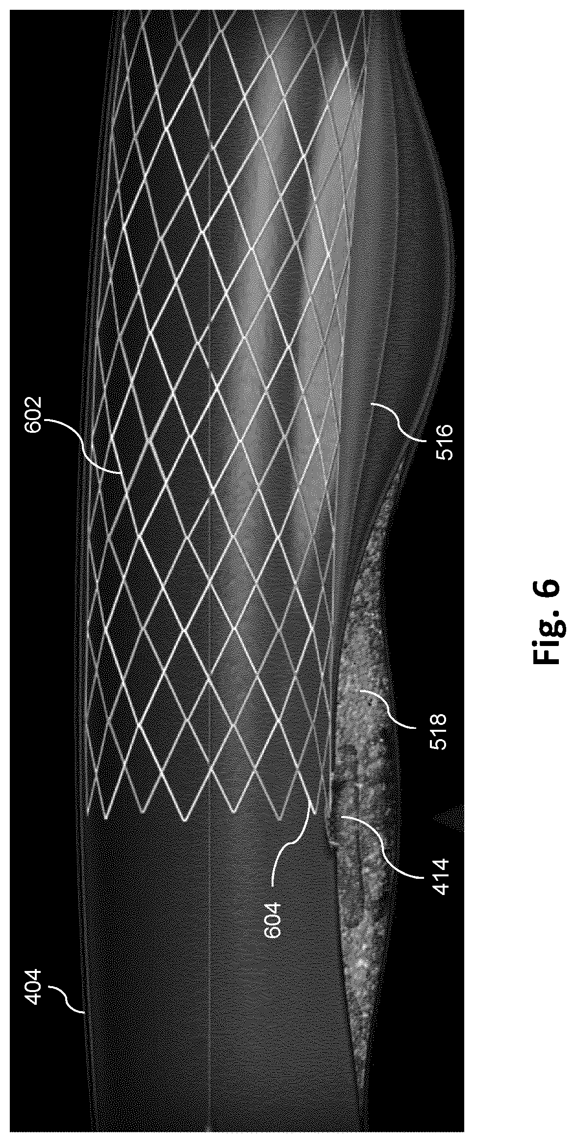 Patent US12551195 Figure 6 – Co-registration of intravascular and extravascular imaging for extravascular image with intravascular tissue morphology
