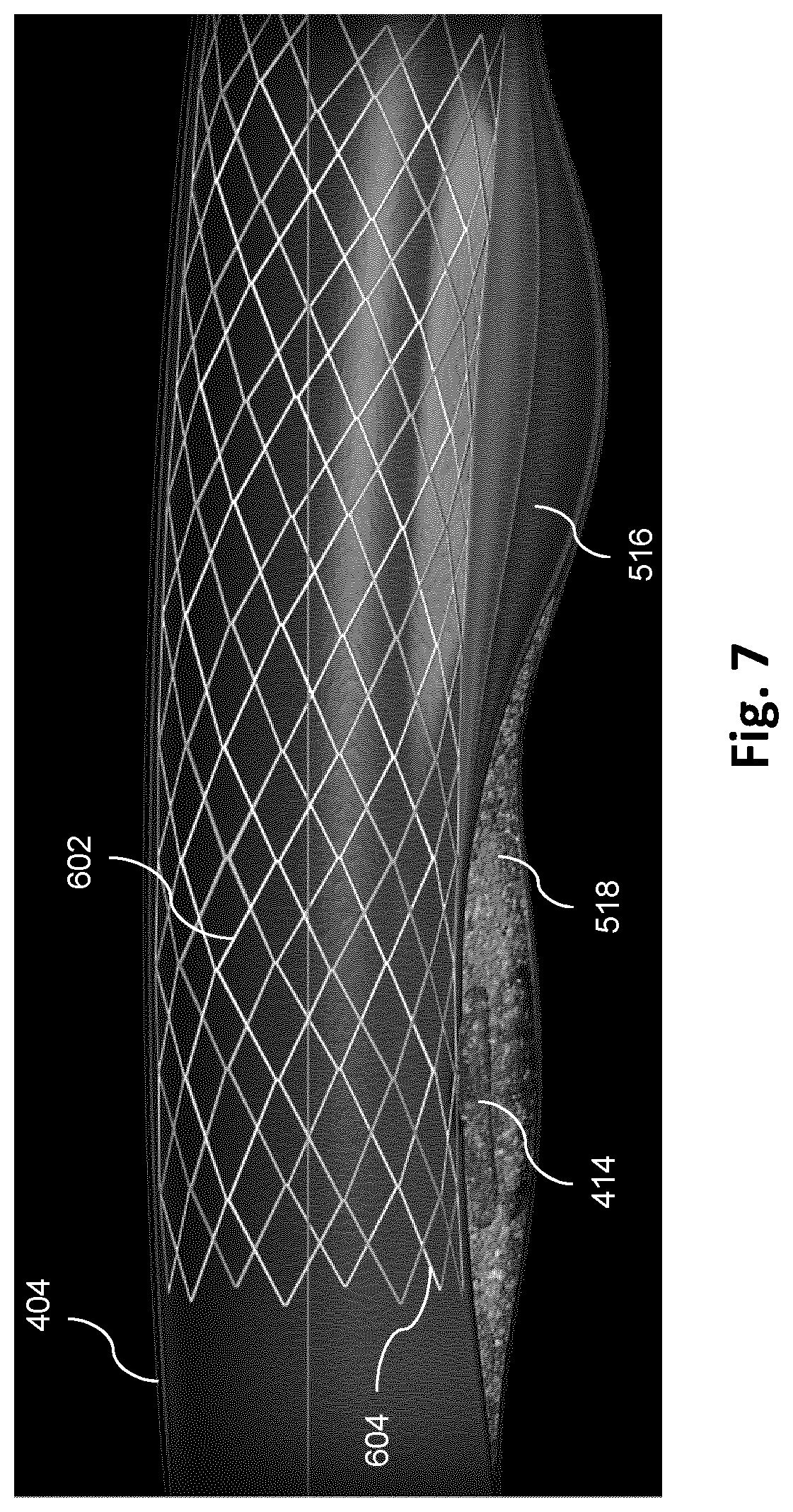 Patent US12551195 Figure 7 – Co-registration of intravascular and extravascular imaging for extravascular image with intravascular tissue morphology