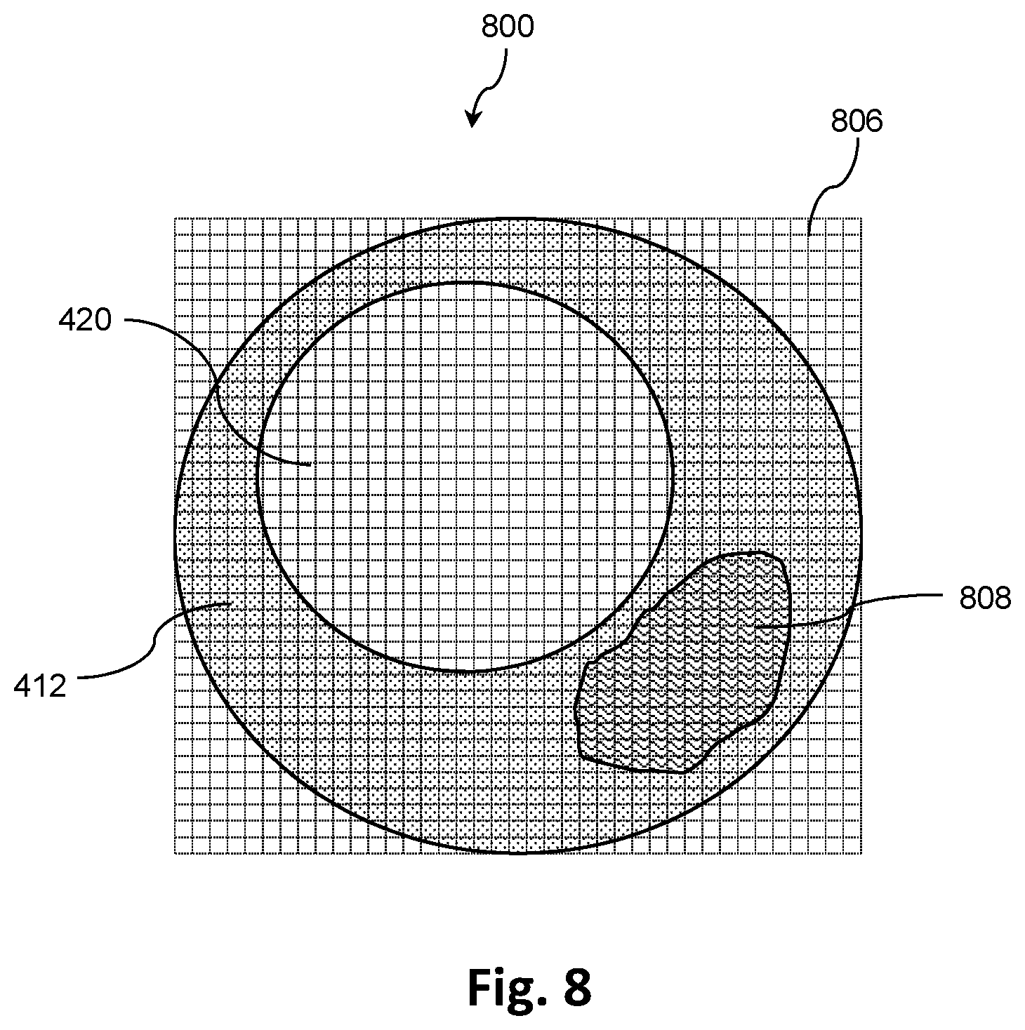 Patent US12551195 Figure 8 – Co-registration of intravascular and extravascular imaging for extravascular image with intravascular tissue morphology
