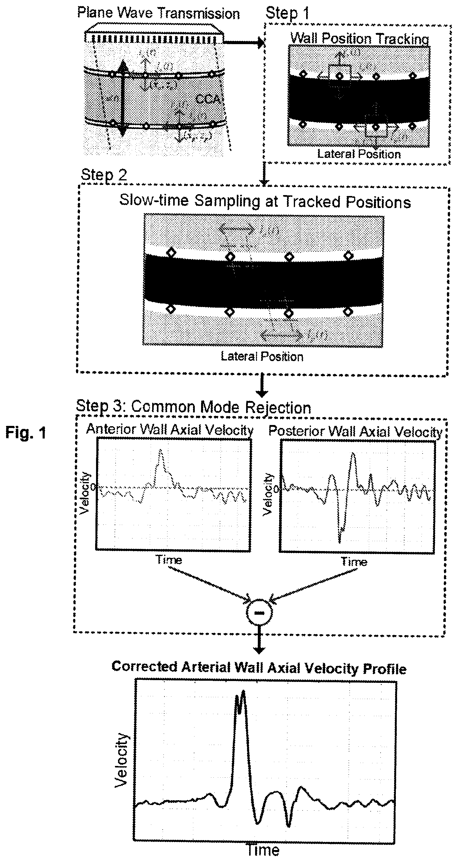 Patent US12551196 — Measuring pulse wave velocity using ultrasound — Figure 1