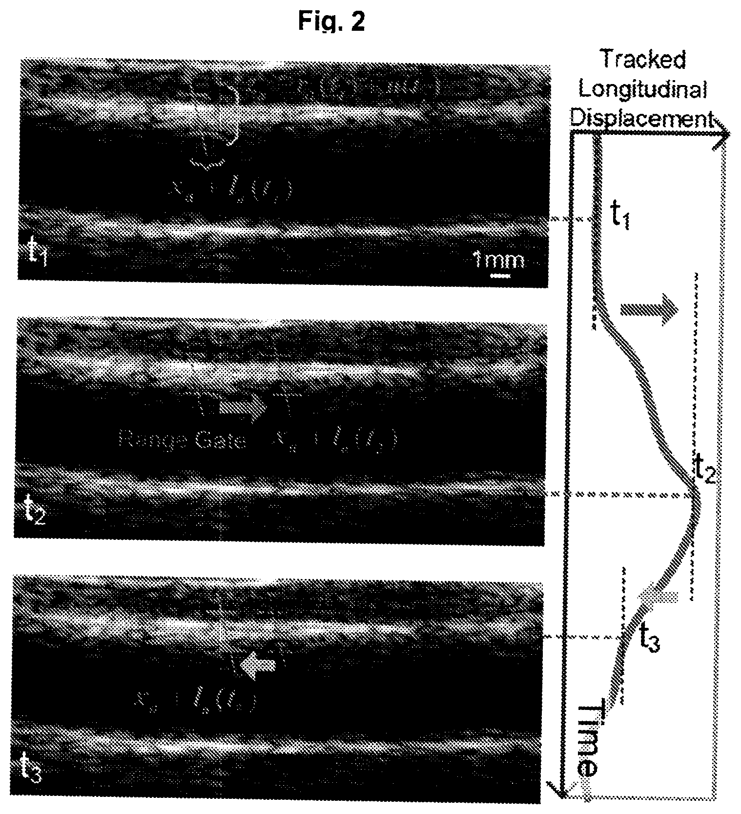 Patent US12551196 Figure 2 – Measuring pulse wave velocity using ultrasound