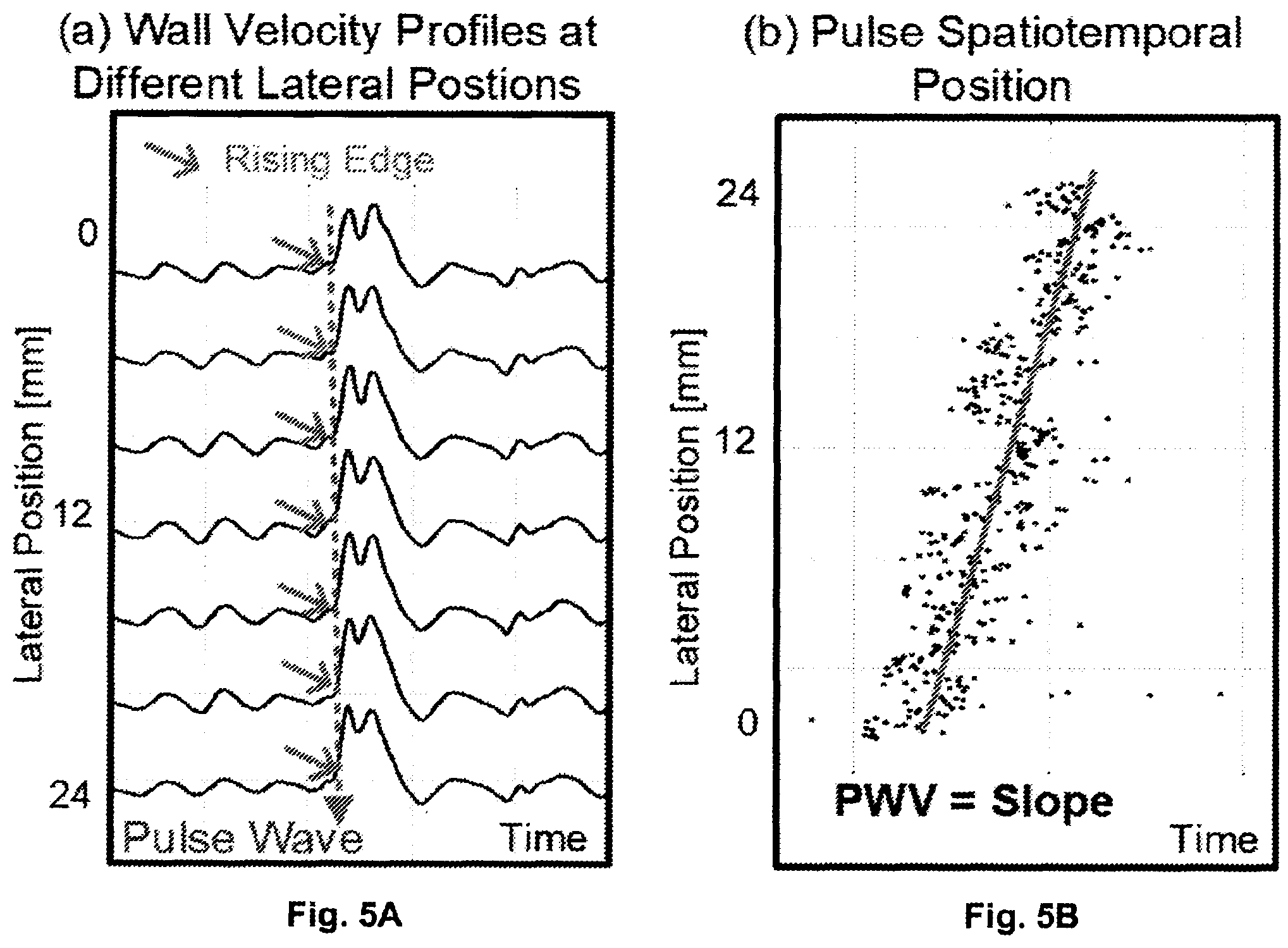 Patent US12551196 Figure 5 – Measuring pulse wave velocity using ultrasound