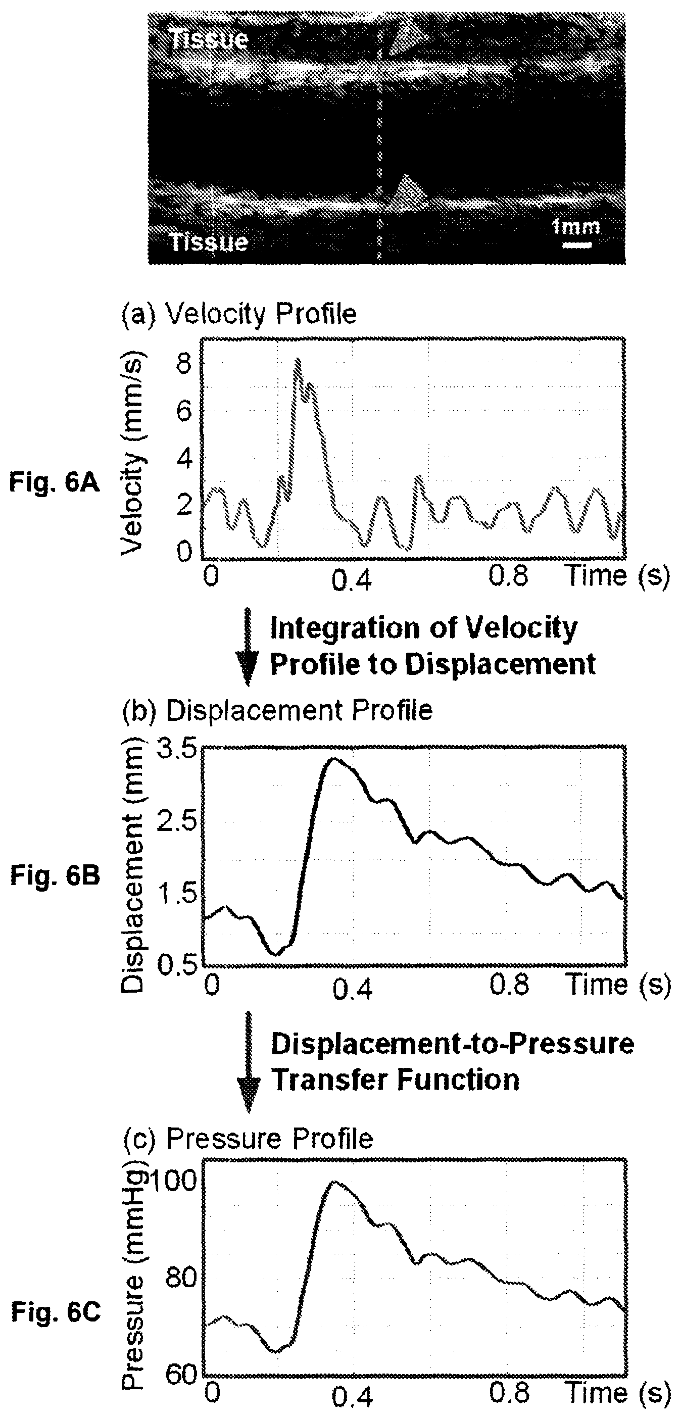 Patent US12551196 Figure 6 – Measuring pulse wave velocity using ultrasound