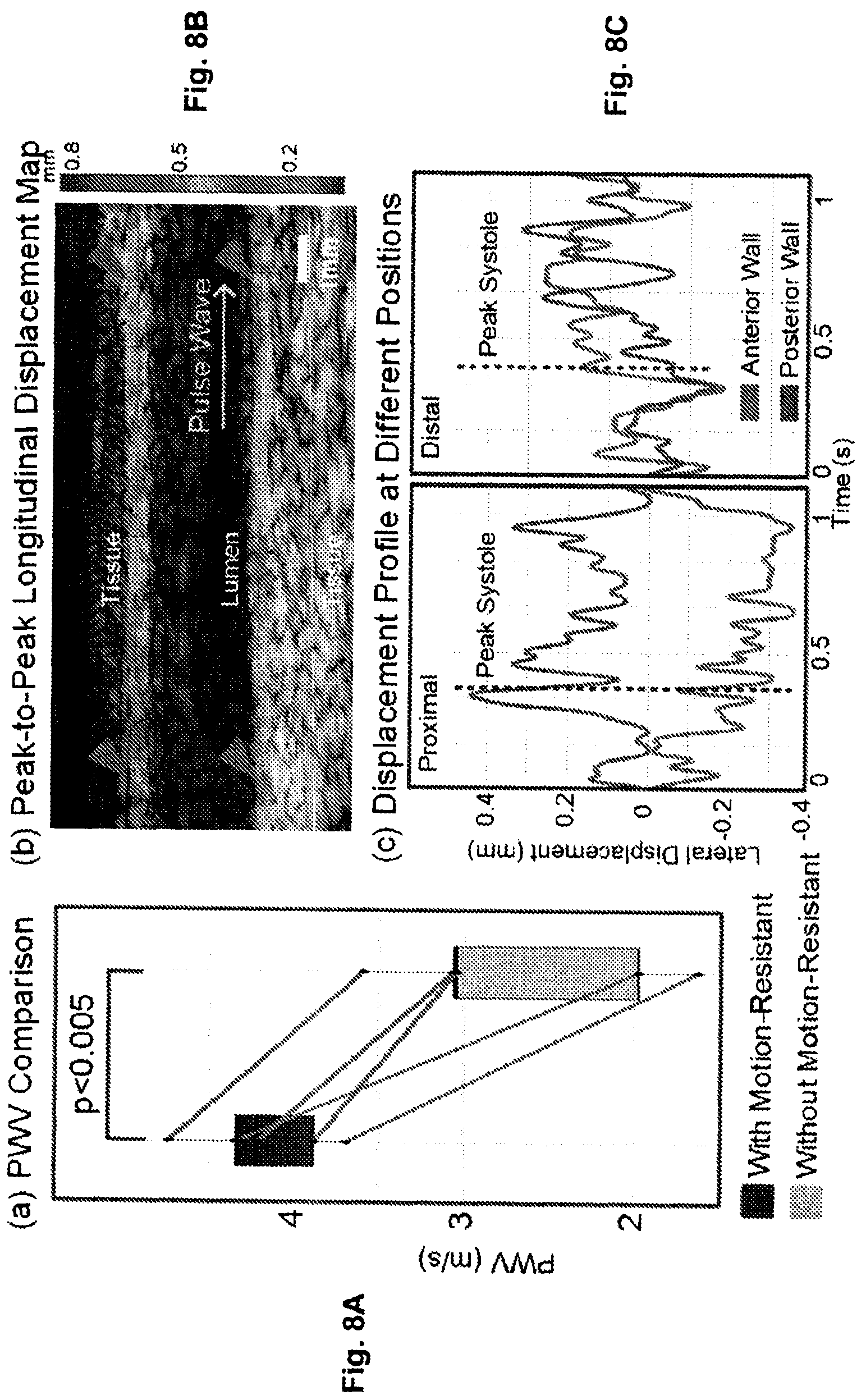 Patent US12551196 Figure 8 – Measuring pulse wave velocity using ultrasound