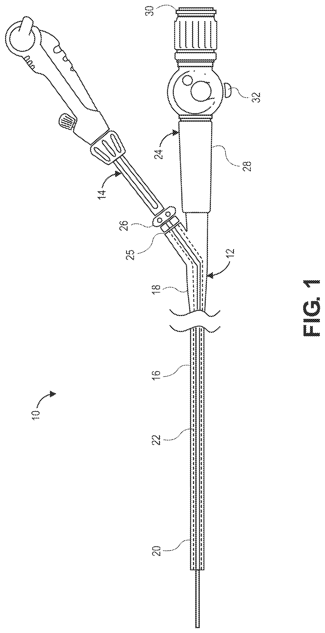 Patent US12551204 — Lung access device — Figure 1