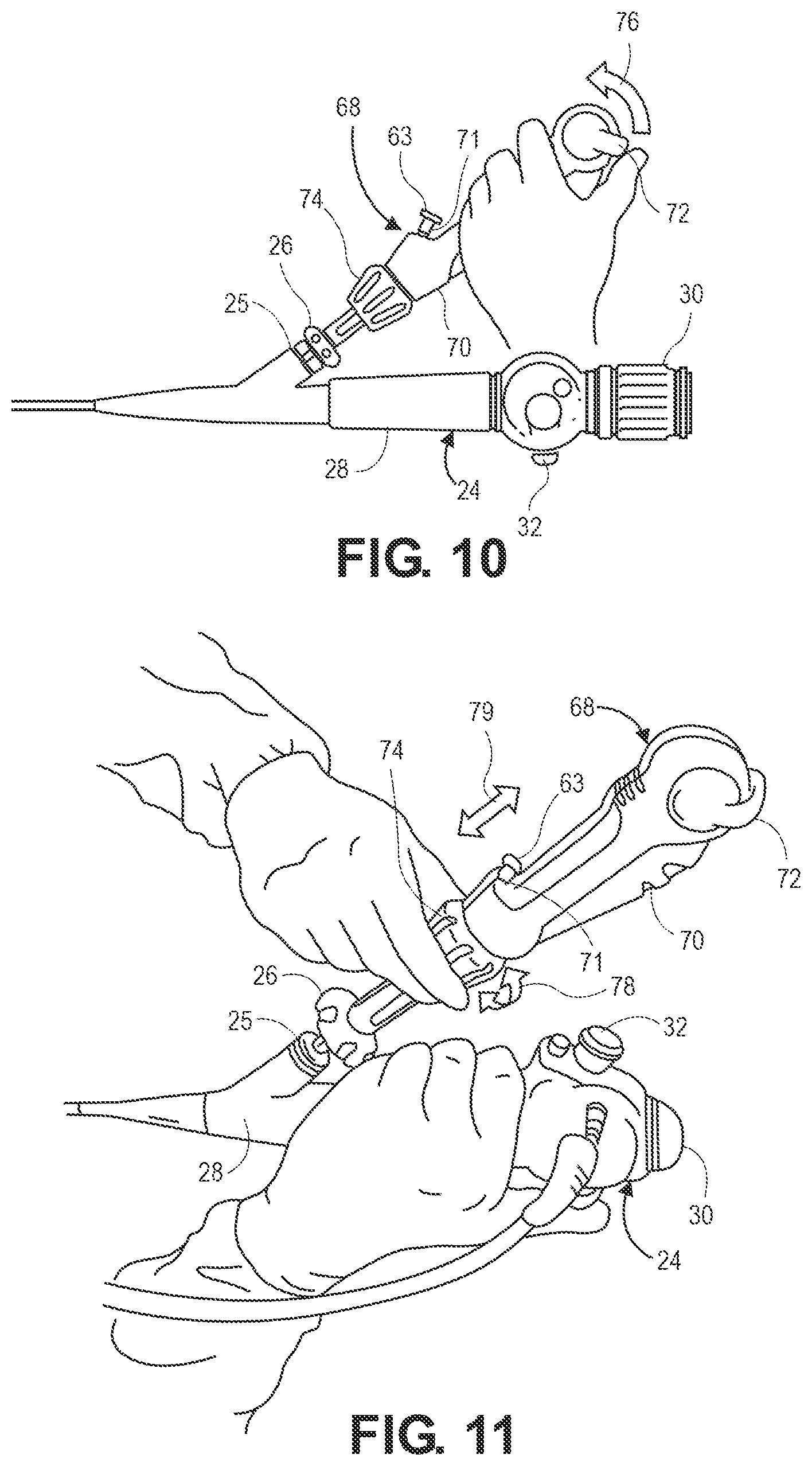 Patent US12551204 Figure 9 – Lung access device