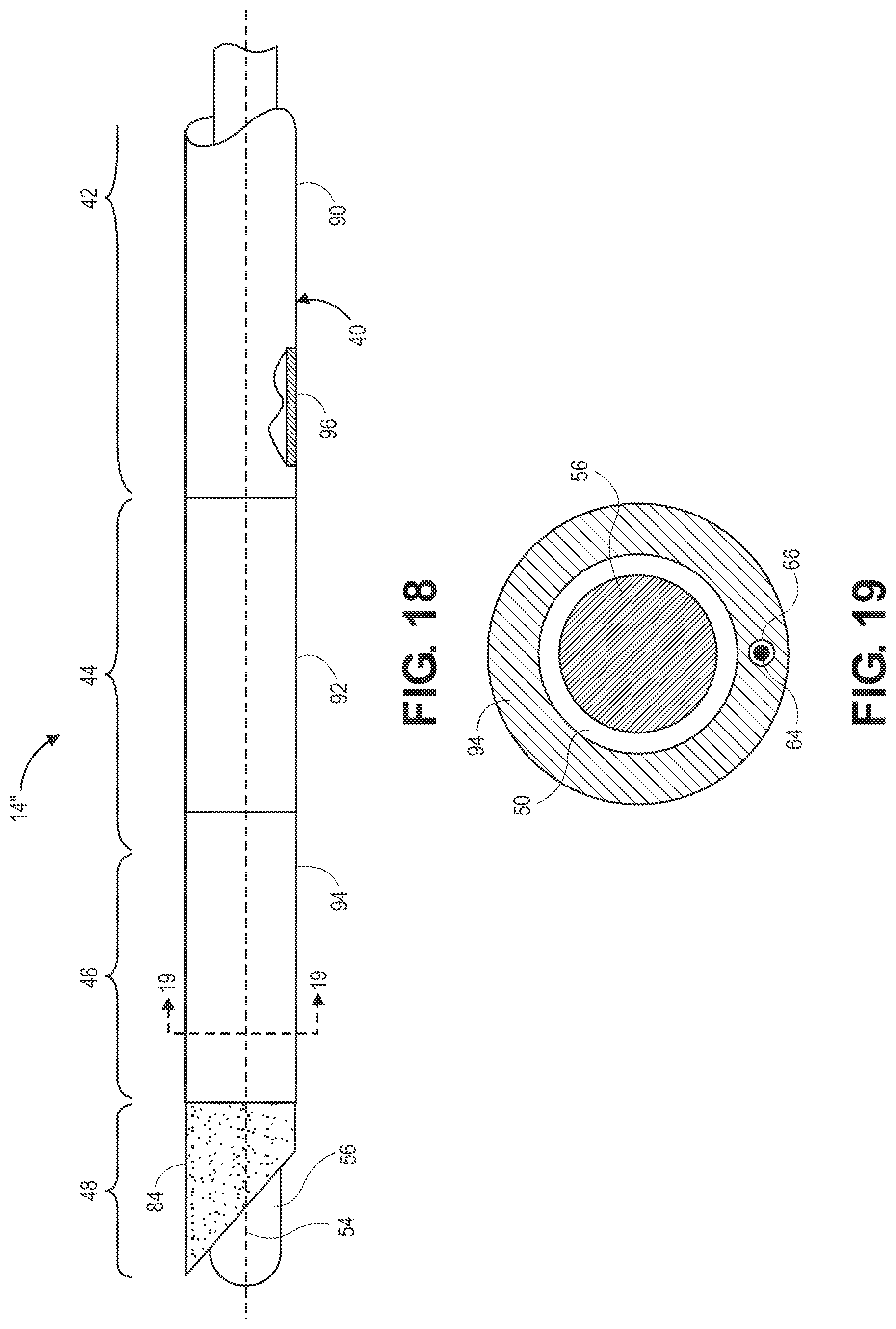 Patent US12551204 Figure 13 – Lung access device