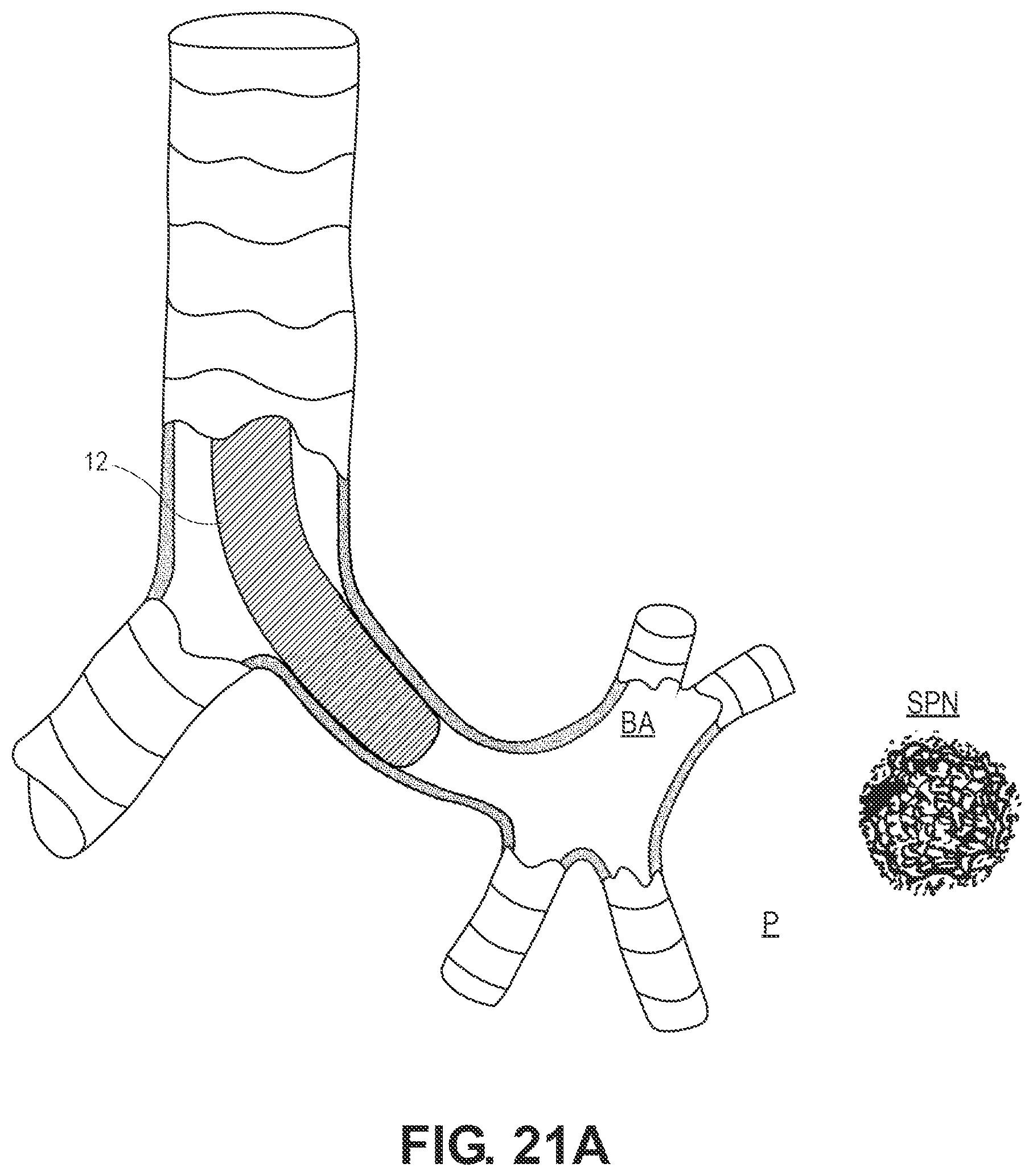 Patent US12551204 Figure 16 – Lung access device