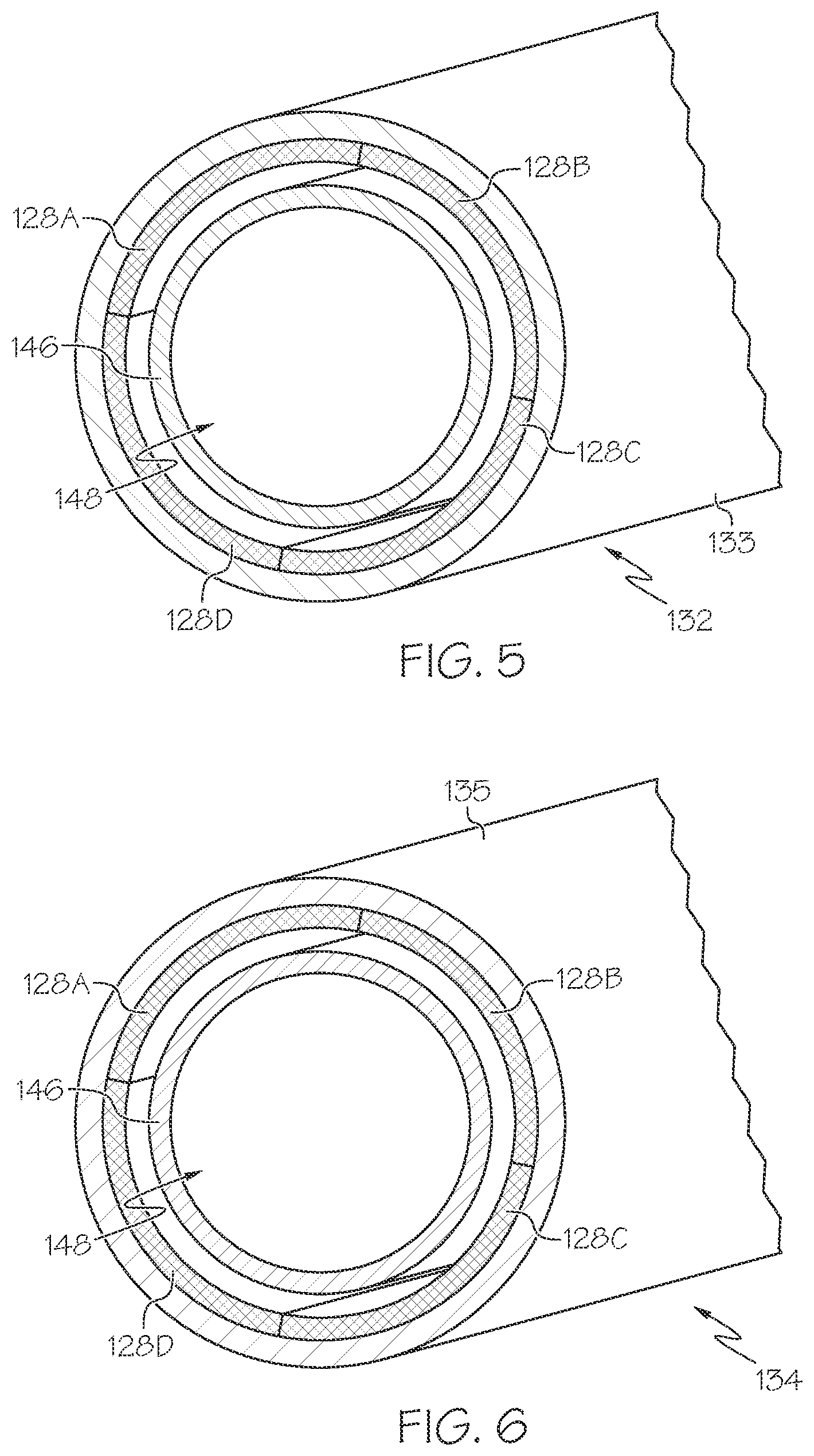 Patent US12551205 Figure 3 – Medical articulation devices and methods of using the same